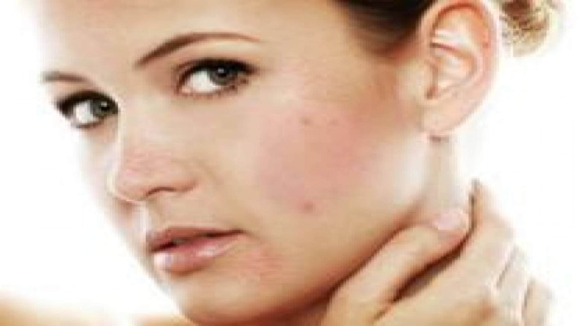 الإصابة بالخراج تستلزم الاهتمام بالنظافة‬