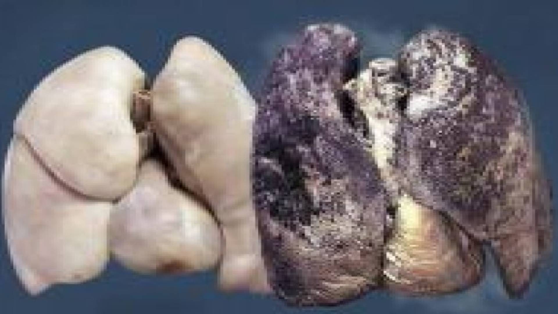 العلماء يكتشفون سر بقاء رئة بعض المدخنين سليمة