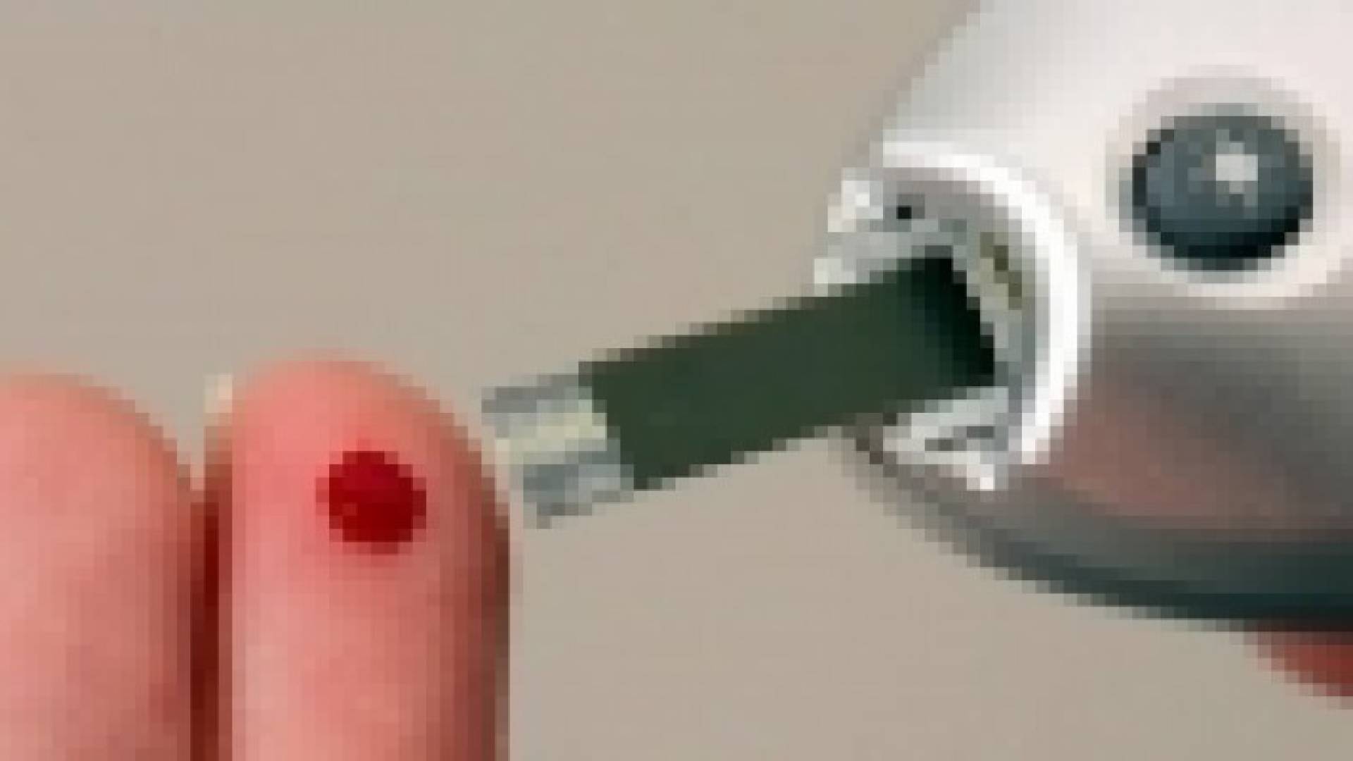 السكري وأمراض القلب يعزز كل منهما ‫الإصابة بالآخر
