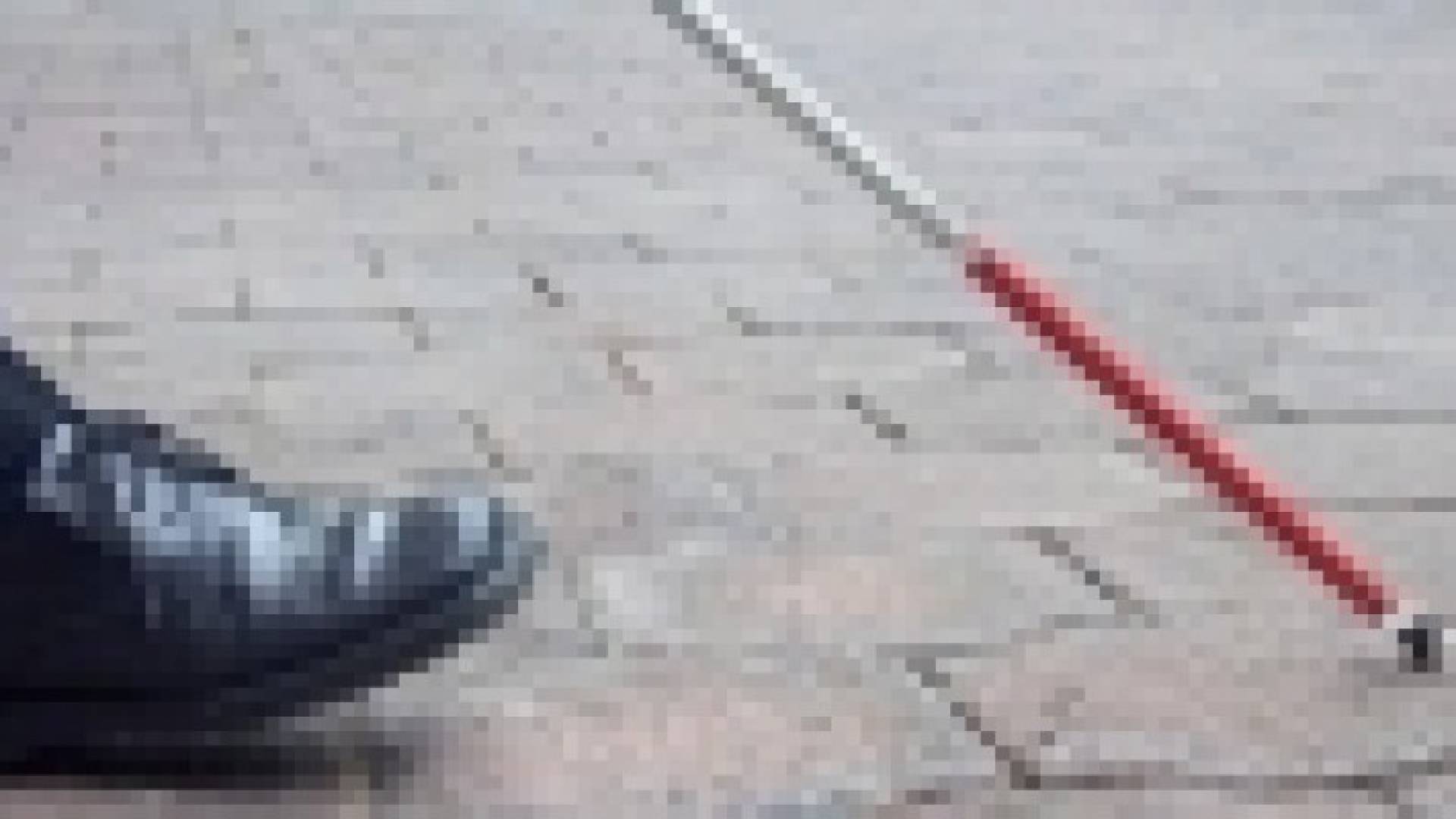 علماء بريطانيون يلجأون إلى الخلايا الجذعية لعلاج العمى