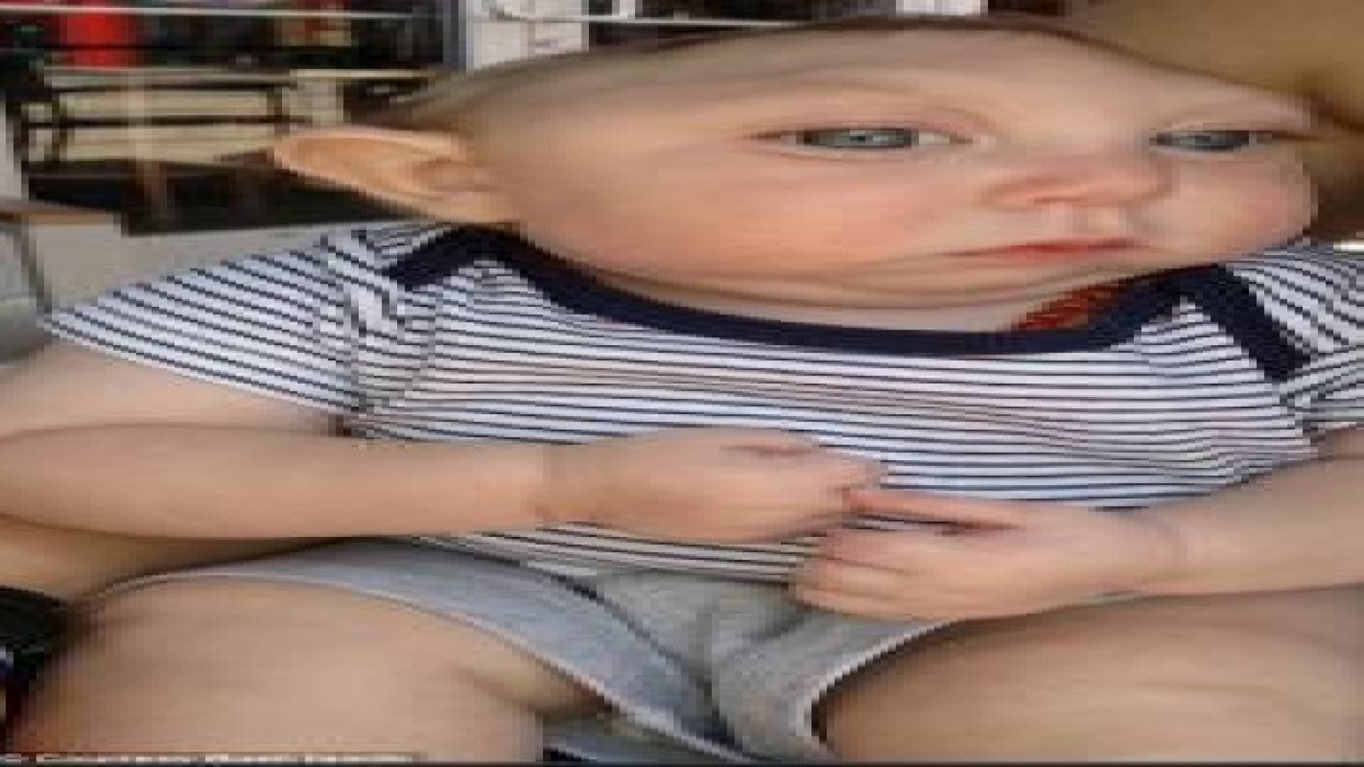 جاكسون بويل طفل ولد دون جمجمة كاملة ..فيديو وصور