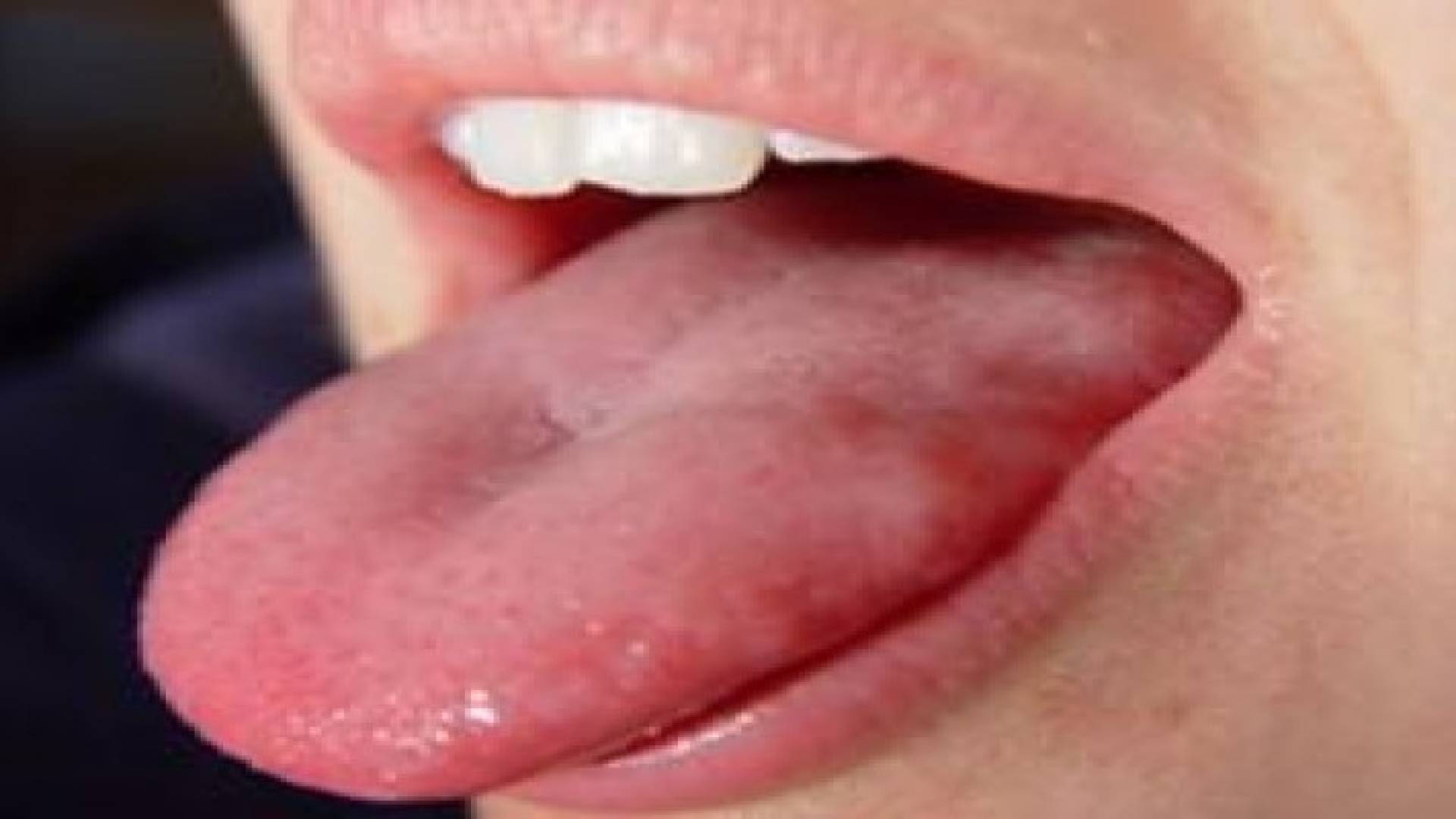 ما لون اللسان الطبيعي؟