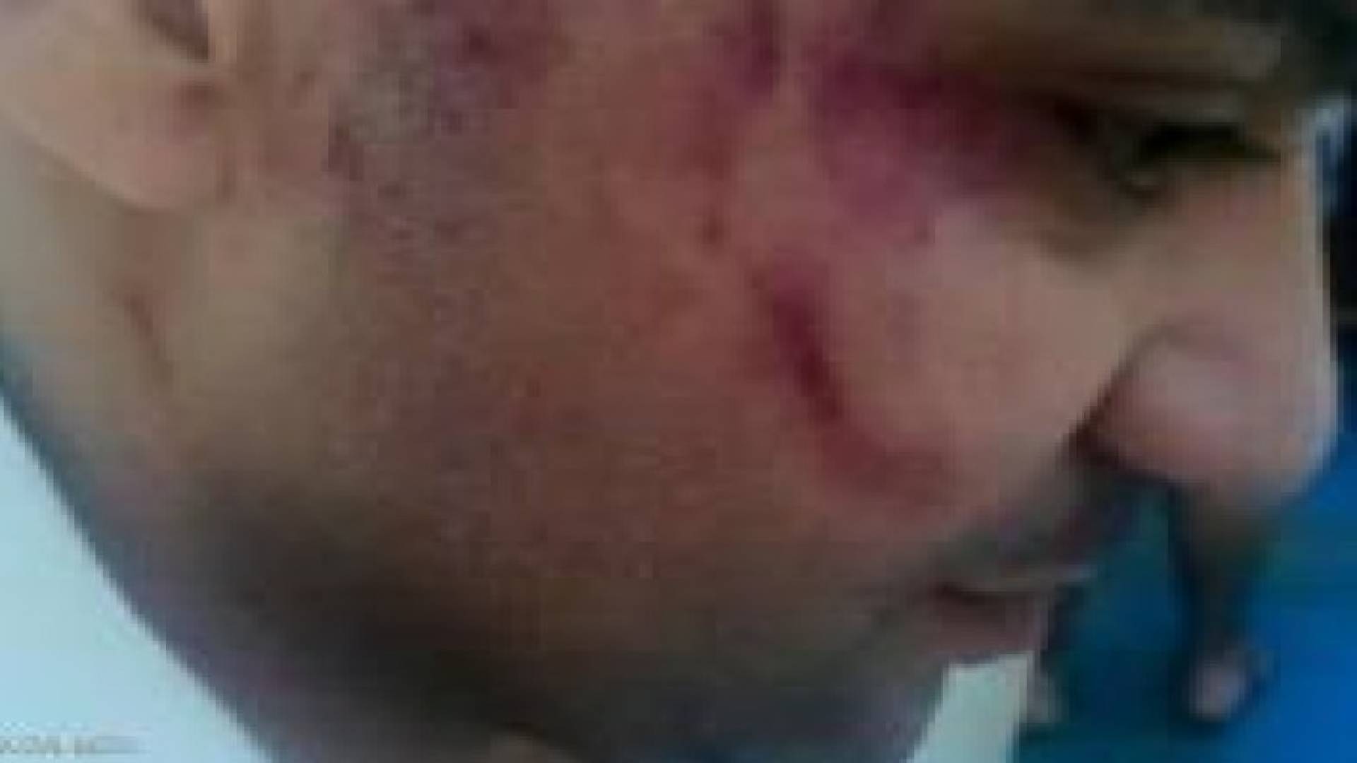 القاء القبض على المعتدين على احد افراد العمالة المصرية بالعقبة