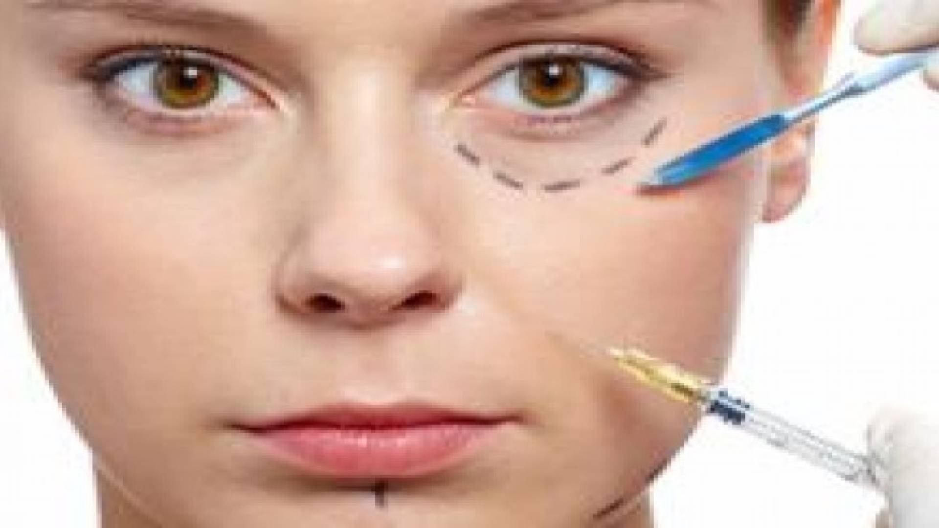 حقن التجاعيد الأكثر مبيعا بمجال التجميل