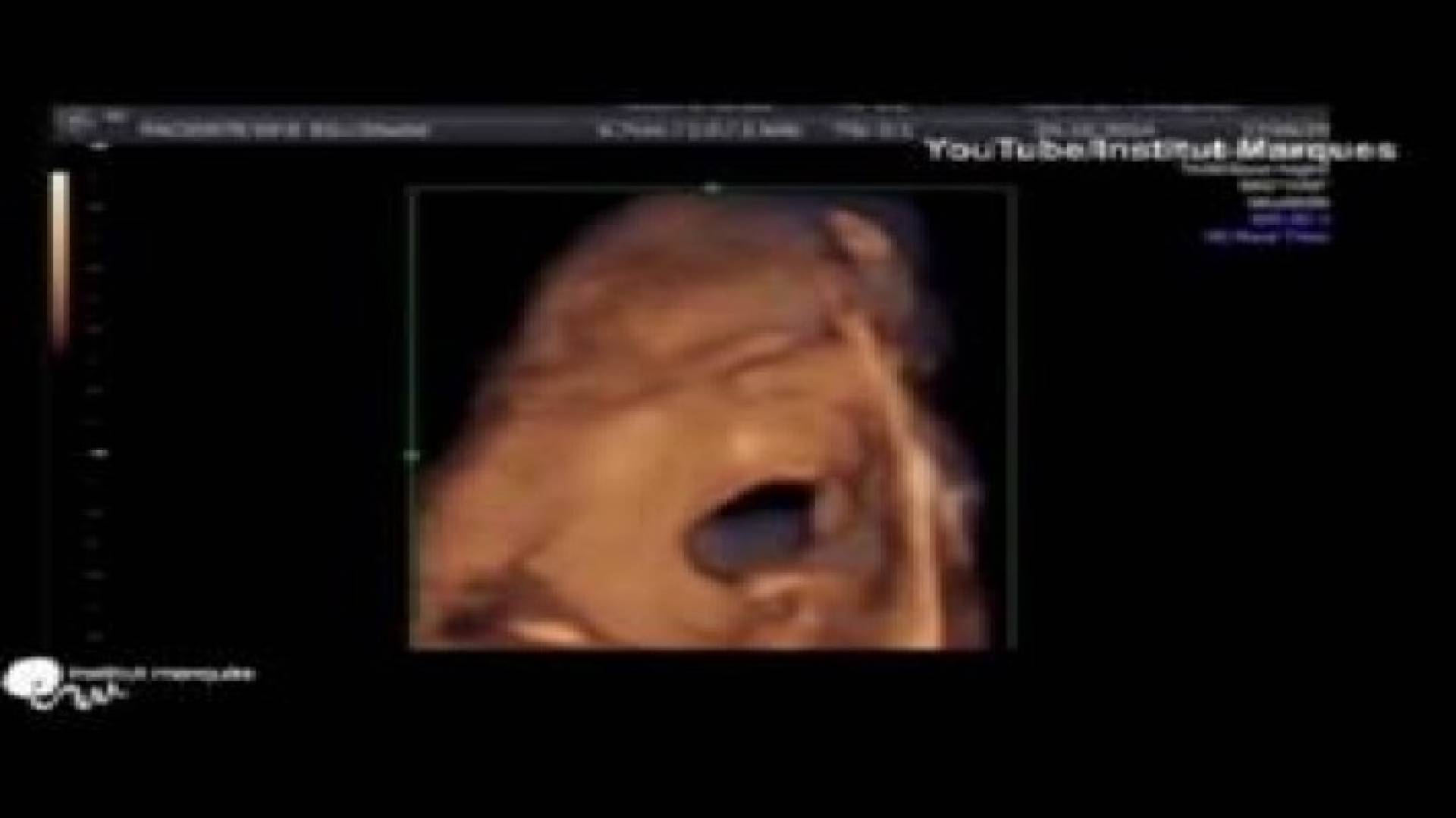 بالفيديو.. طفل "يغني" وهو في بطن أمه