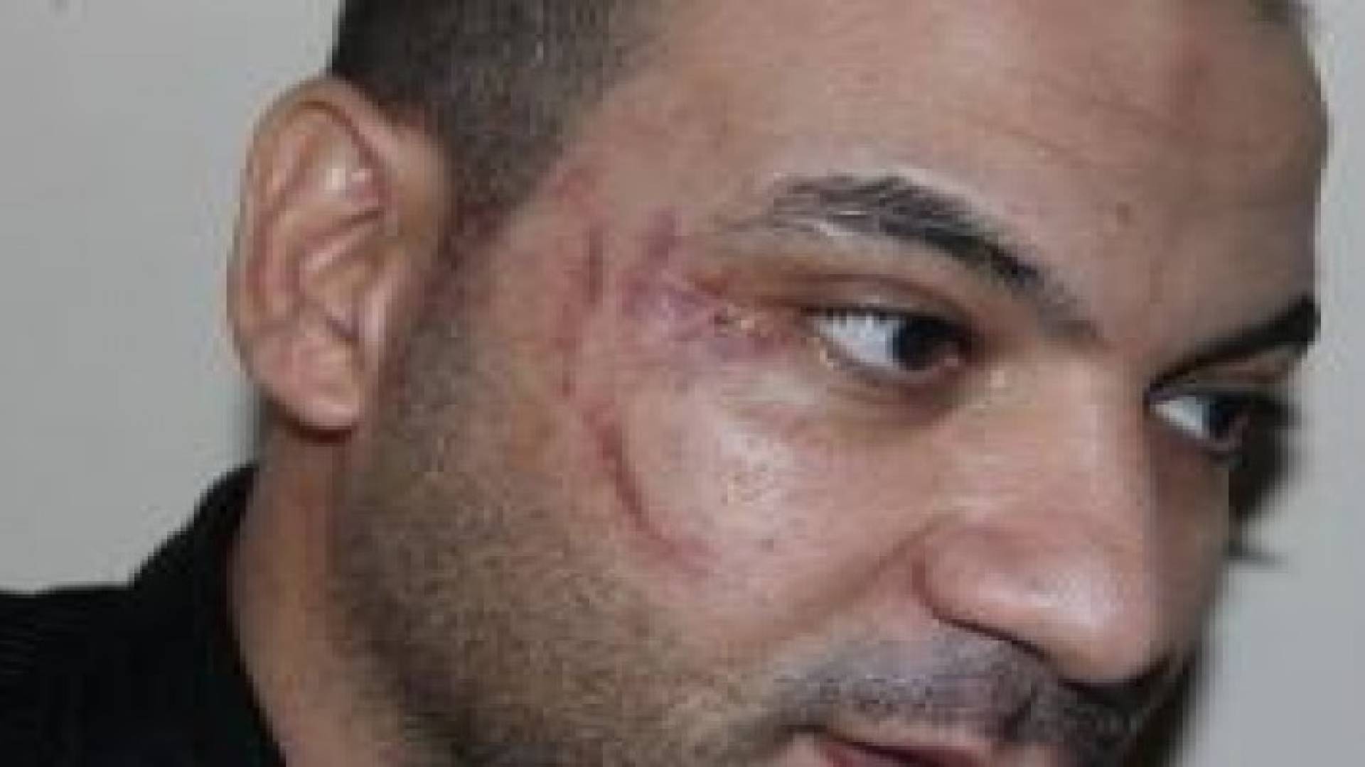القنصل المصري  : خالد السيد لم يسقط حقه الشخصي