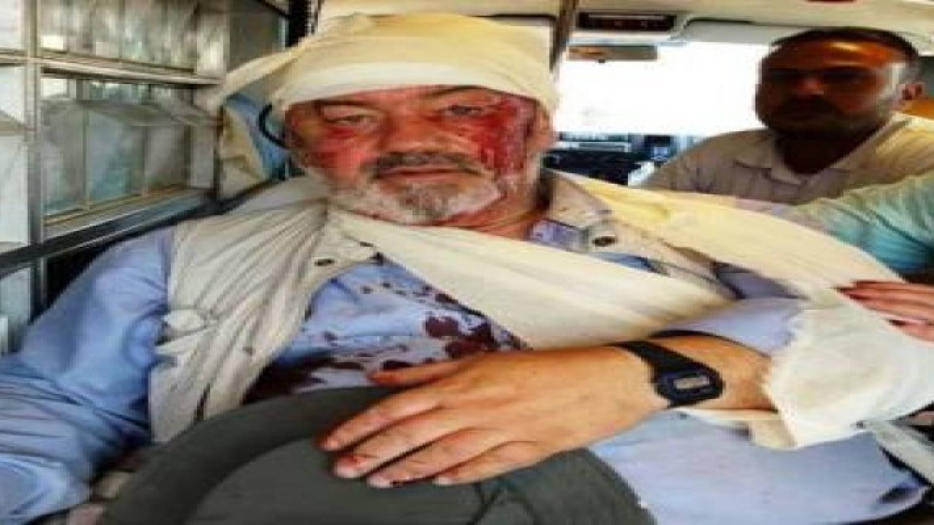 إرهابيون يحرقون حقول زيتون ويعتدون على متضامن بريطاني في بورين