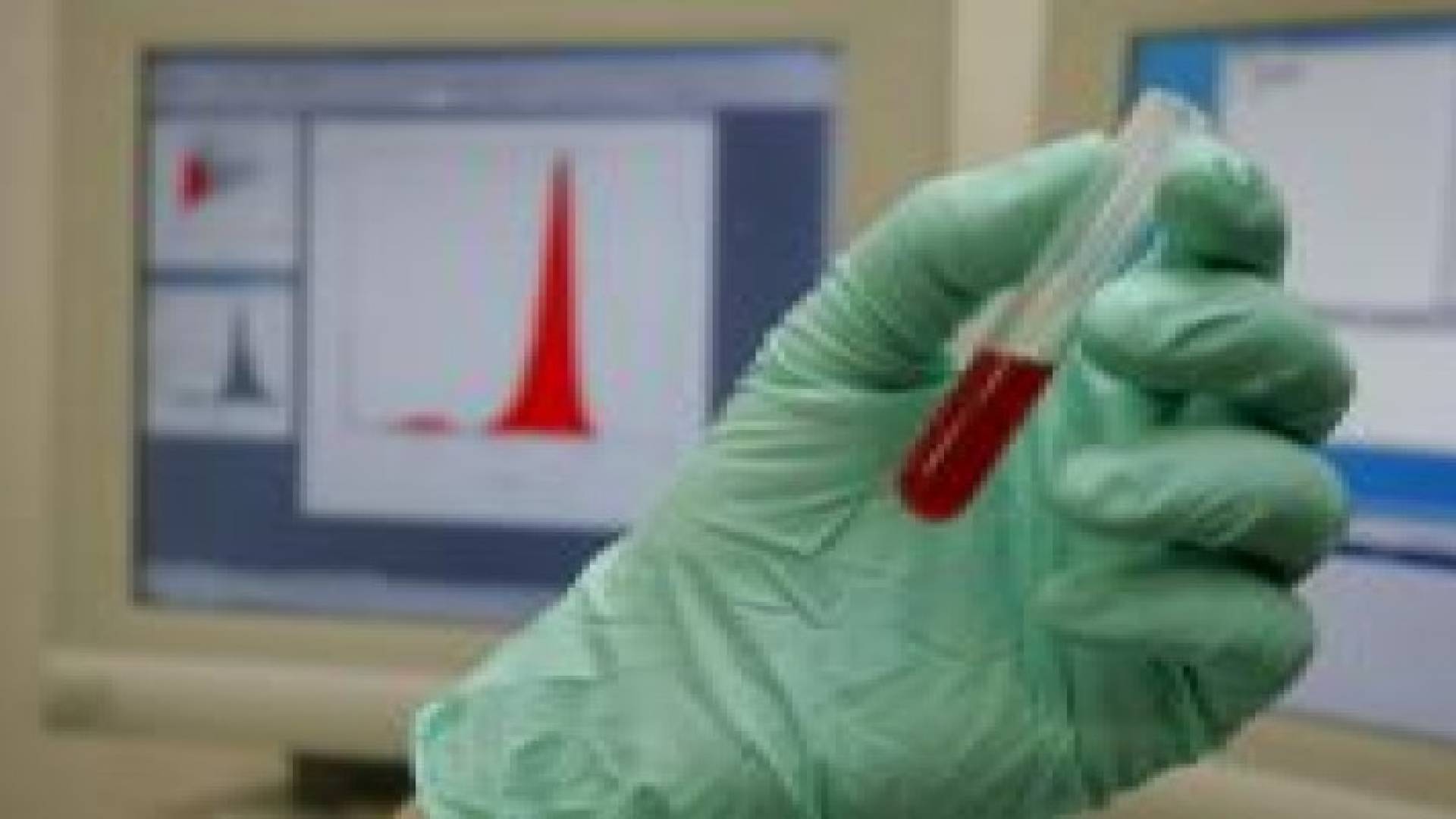 فحص دم يحدد أفضل عقار لمريض السرطان