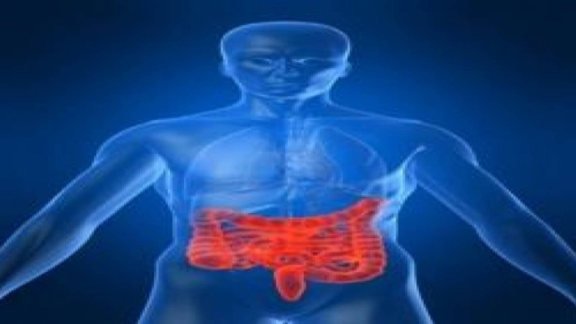 علماء يحددون أربعة أنواع من سرطان القولون