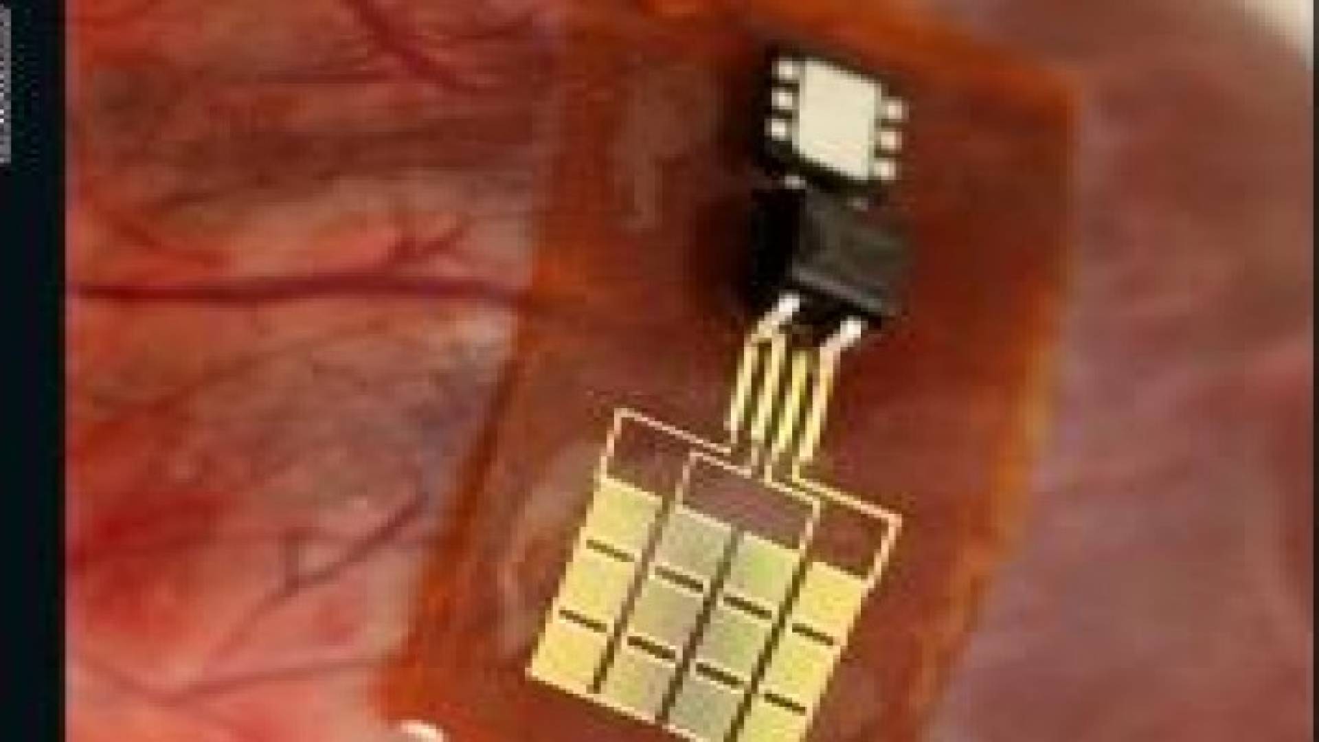 بالصور: ملصق جلدي ذكي يجعل جسمك كالكمبيوتر