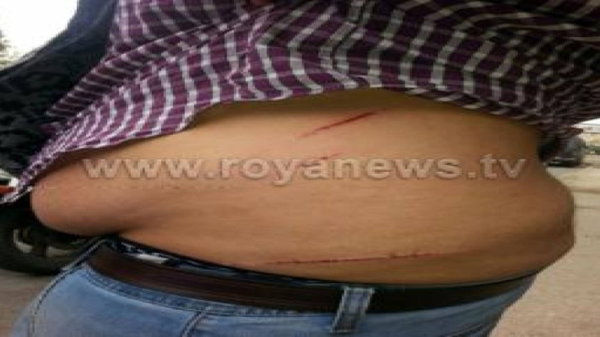 عمان: اصابة شخص اثر مشاجرة بالقرب من دوار الداخلية