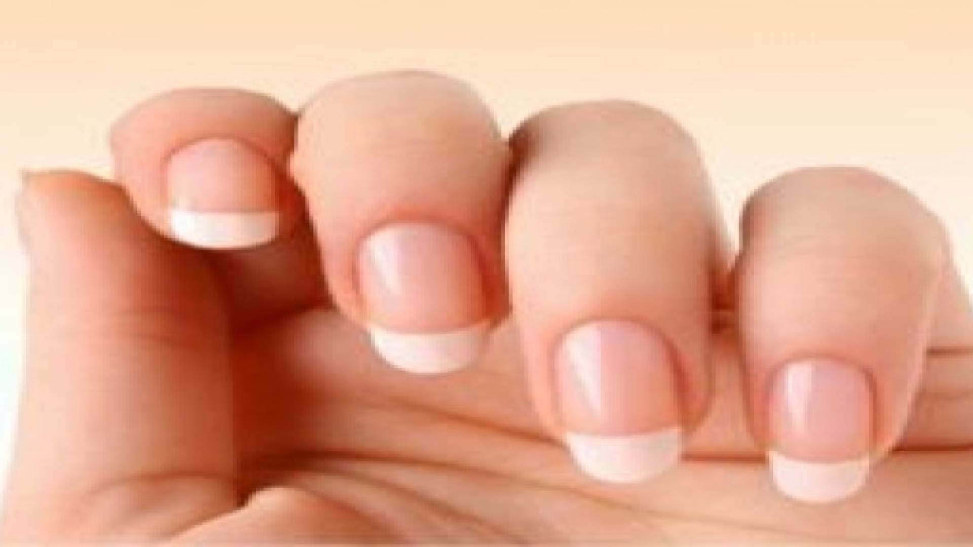 ‫تغيرات الأظافر قد تكون مرضية‬