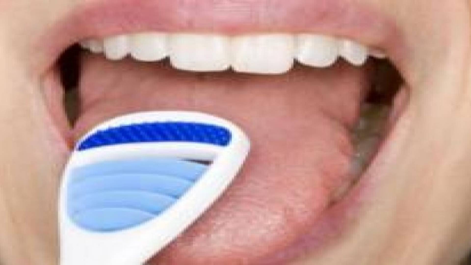 تنظيف اللسان يقضي على رائحة الفم الكريهة‬