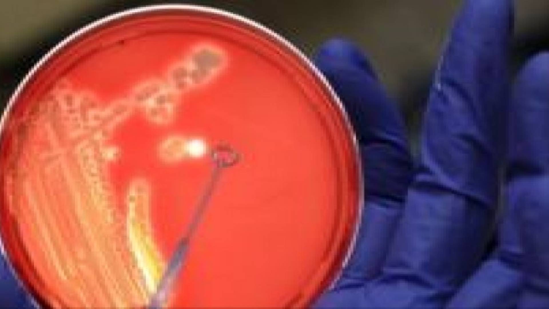 البكتيريا المعوية قد تتحكم بالجوع