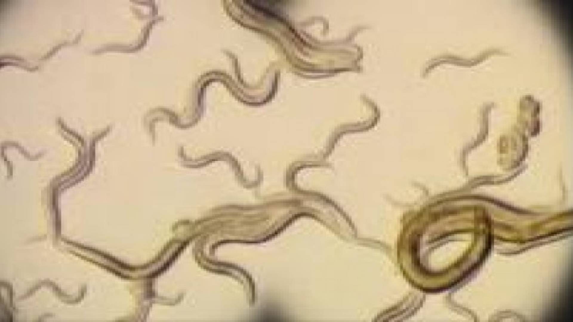 الديدان أمل العلماء في تأخير الشيخوخة