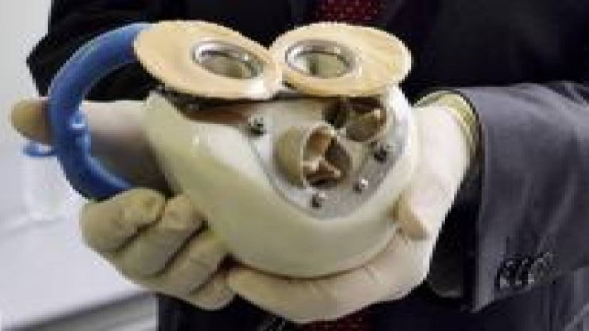 فرنسا.. وفاة ثالث شخص بقلب اصطناعي