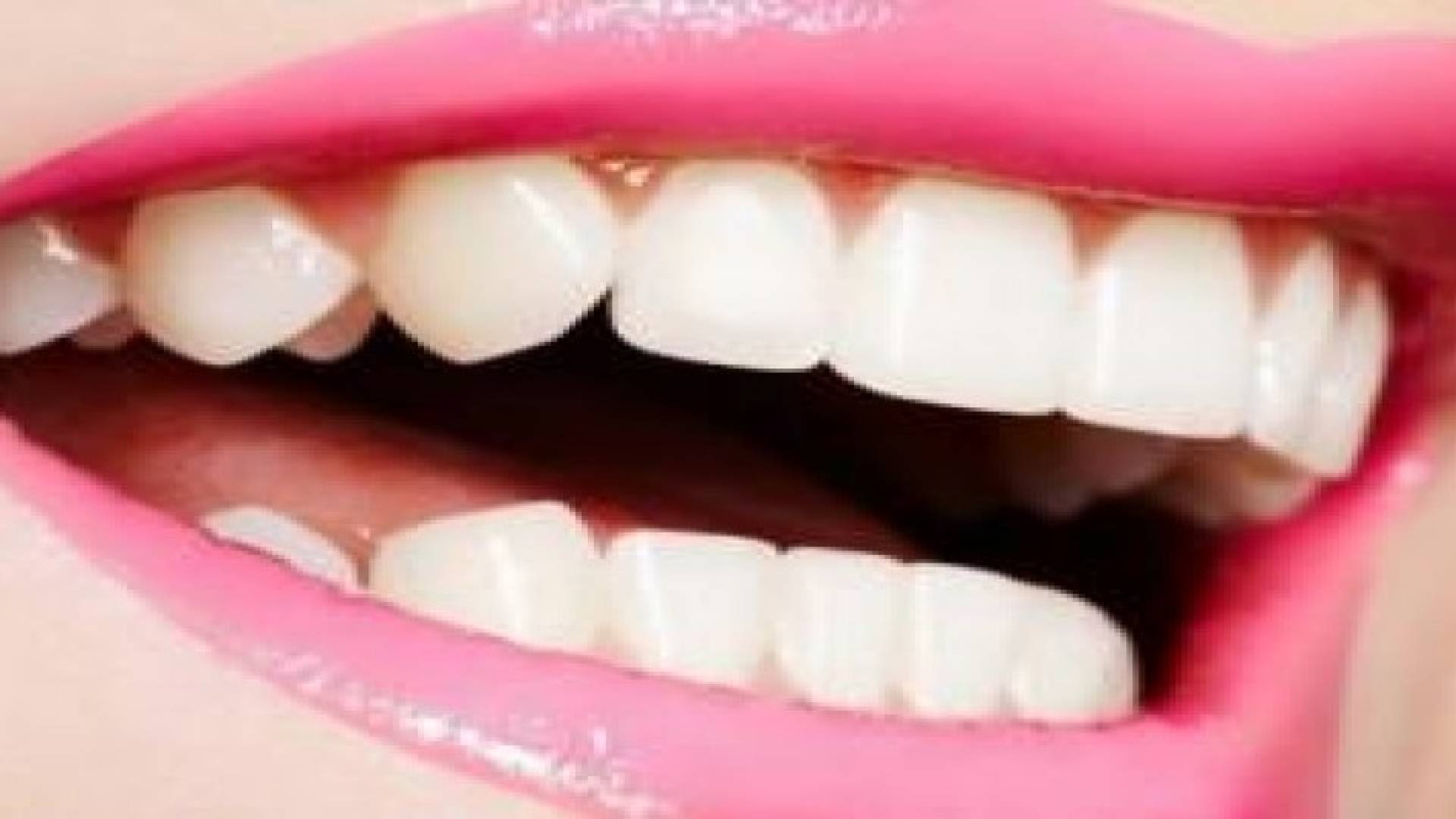 الحمضيات تسبب تآكل الأسنان