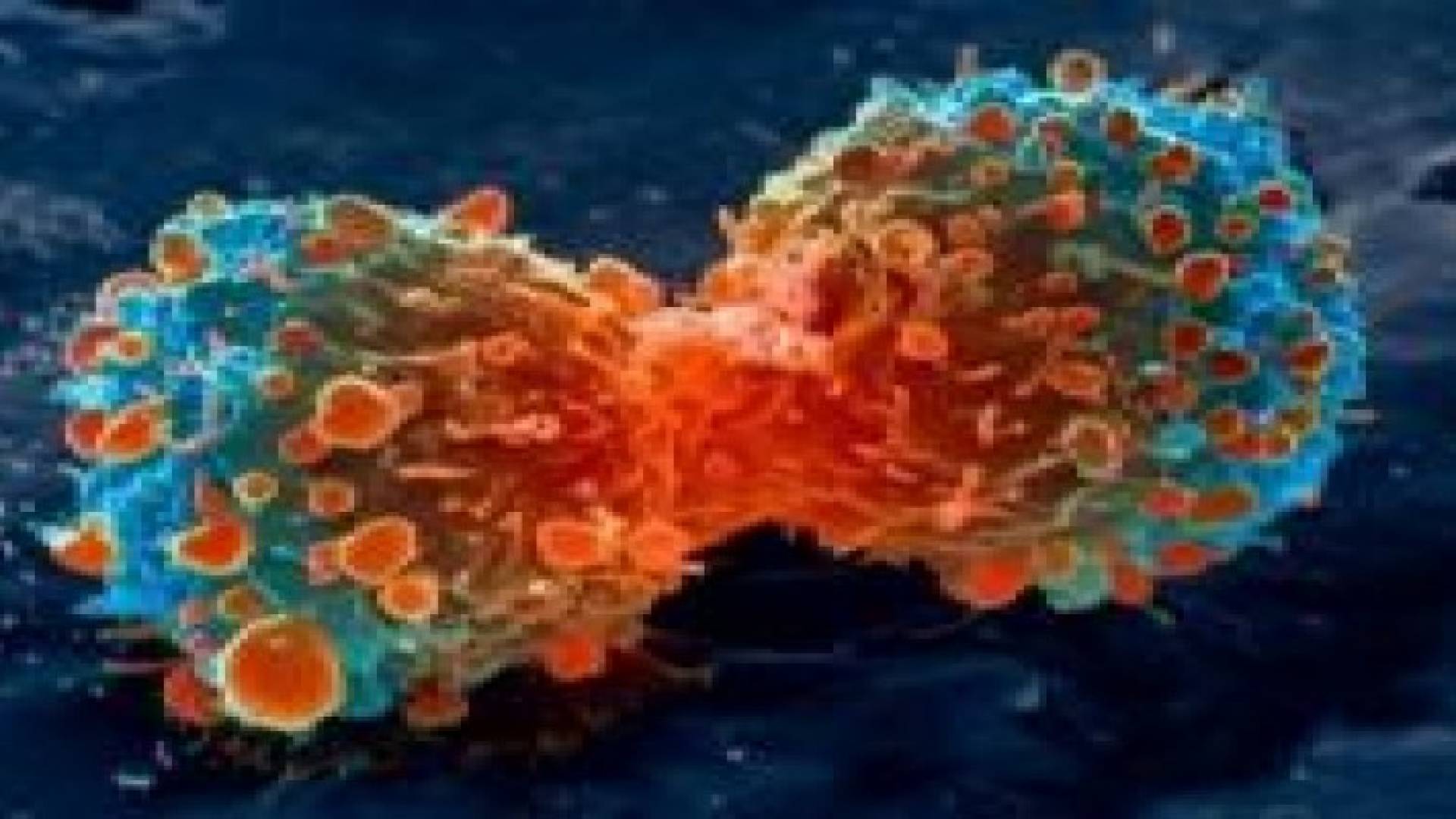 الصين : ابتكار جهاز لتدمير الخلايا السرطانية