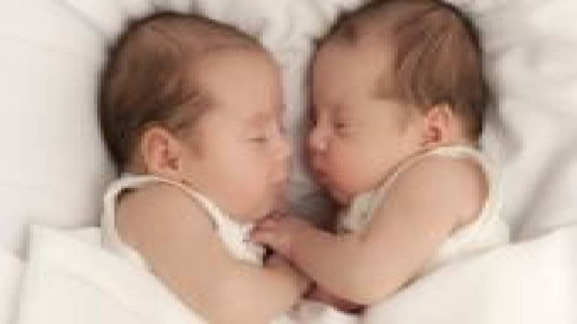 إصابة أحد التوأمين بالسرطان يهدد الآخر