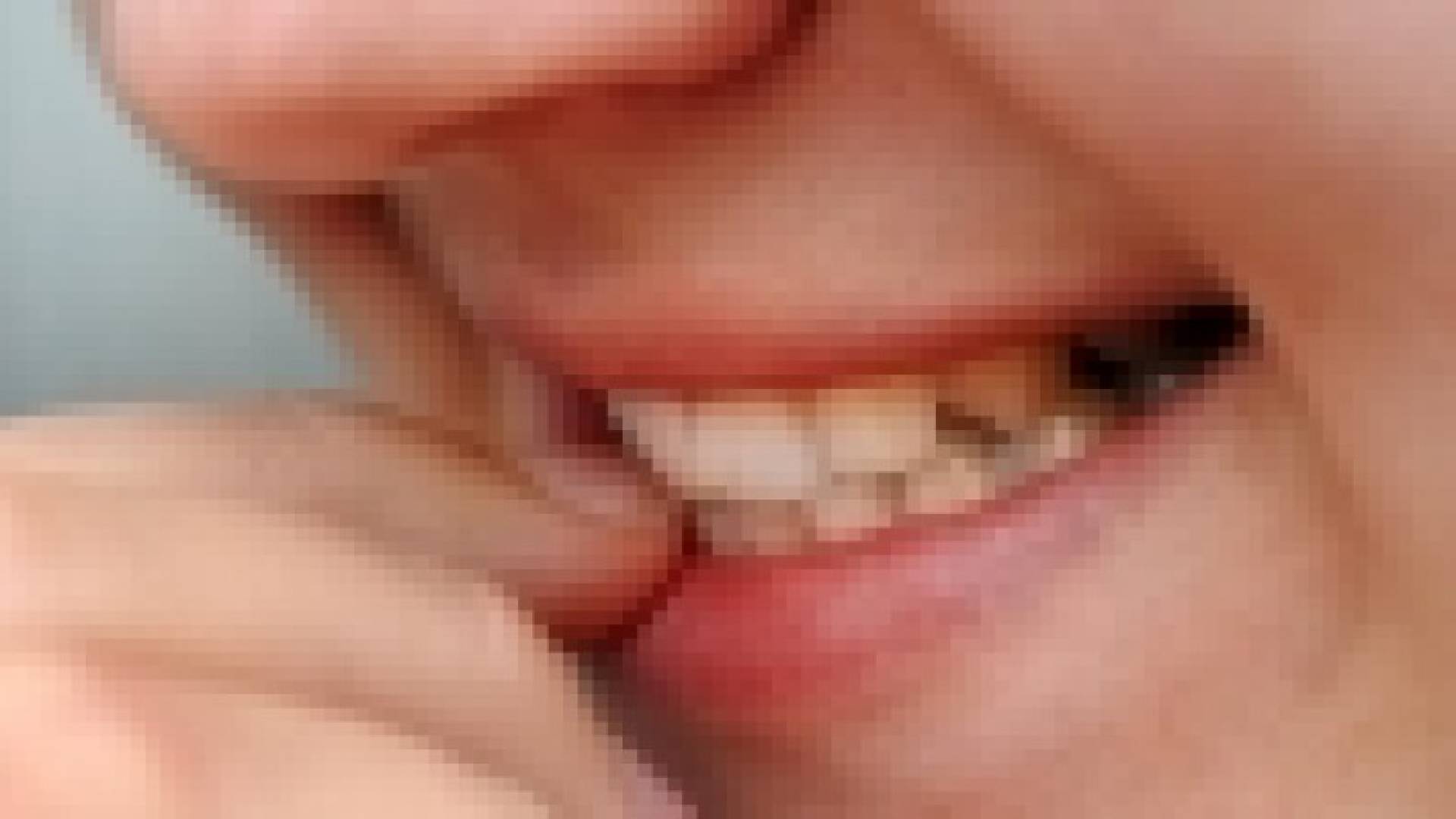 قضم الأظافر قد يصيبها بالتهابات‬