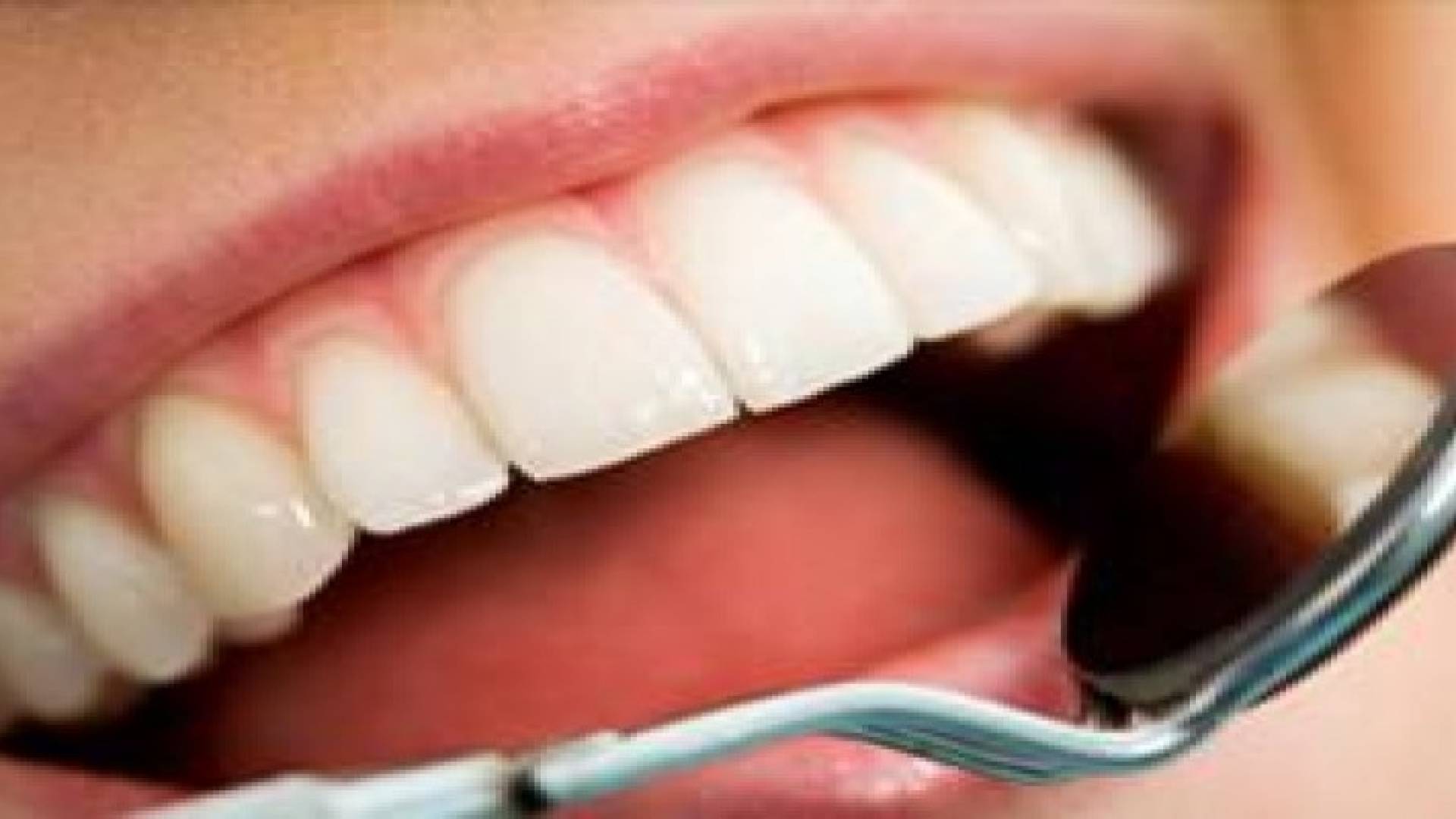 النيكوتين يغطي على علامات التهاب اللثة