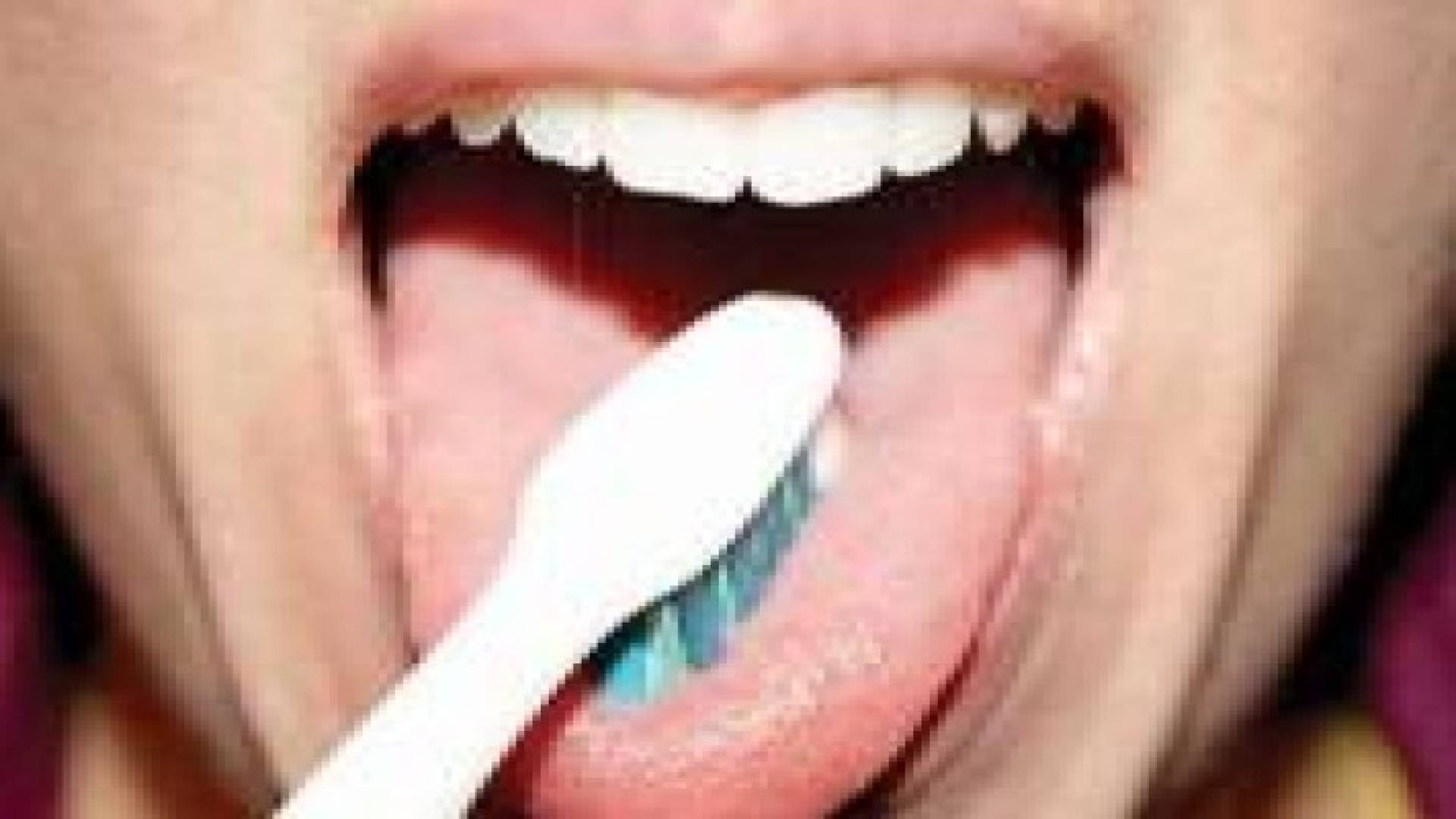 اللسان قد يكون سبب رائحة الفم الكريهة‬