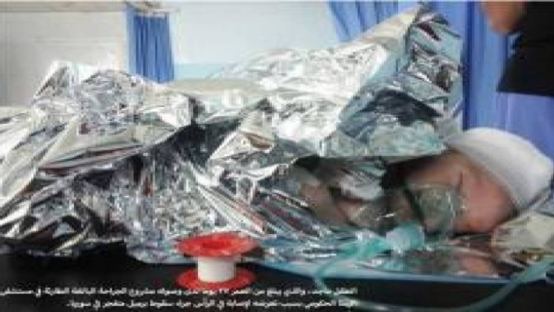 أطباء بلا حدود: رحلة جرحى الحرب السوريين لإعادة بناء أجسادهم وعقولهم في الأردن