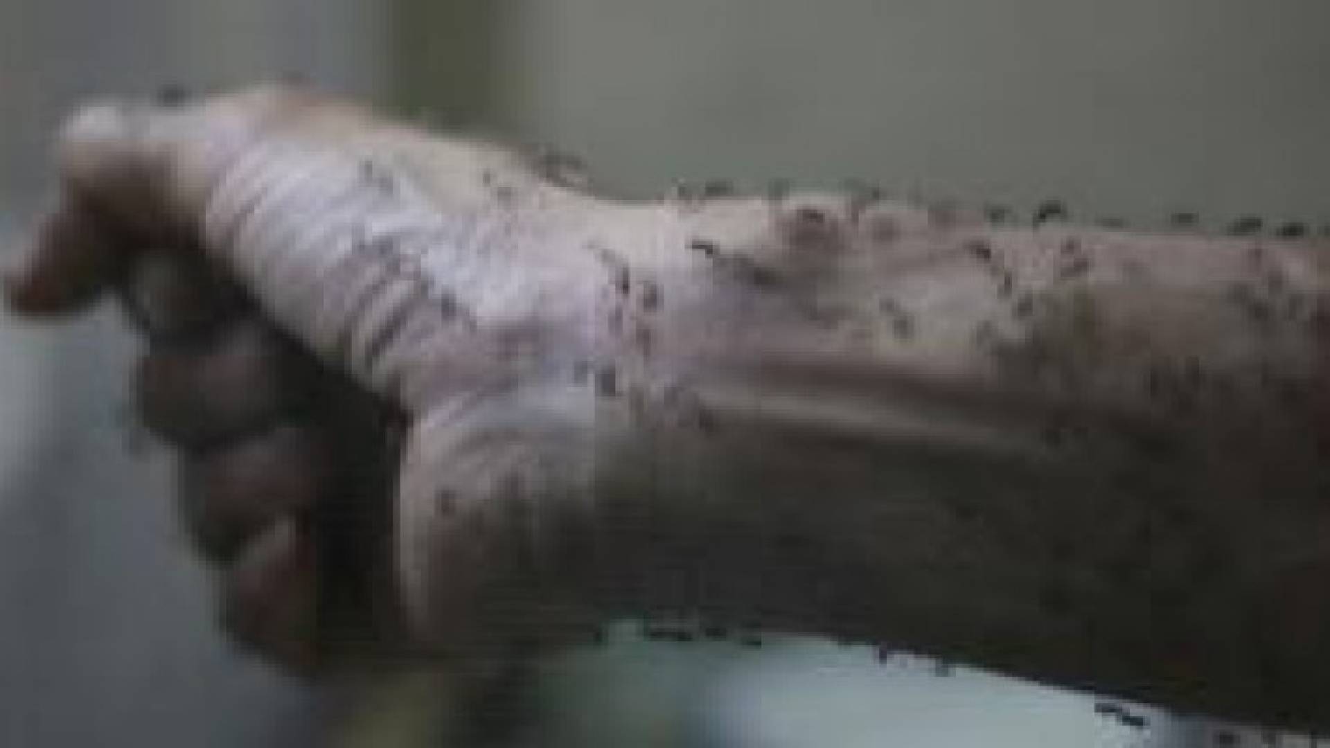 حمى "زيكا" قد تصبح وباء شاملا