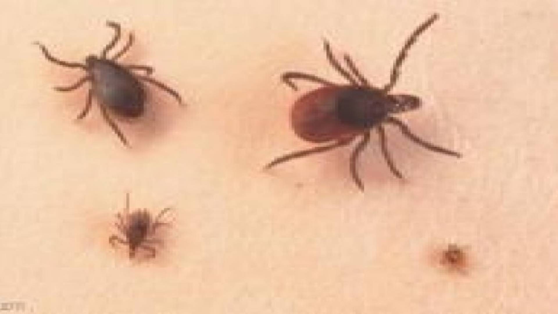 اكتشاف بكتيريا جديدة تسبب مرض لايم