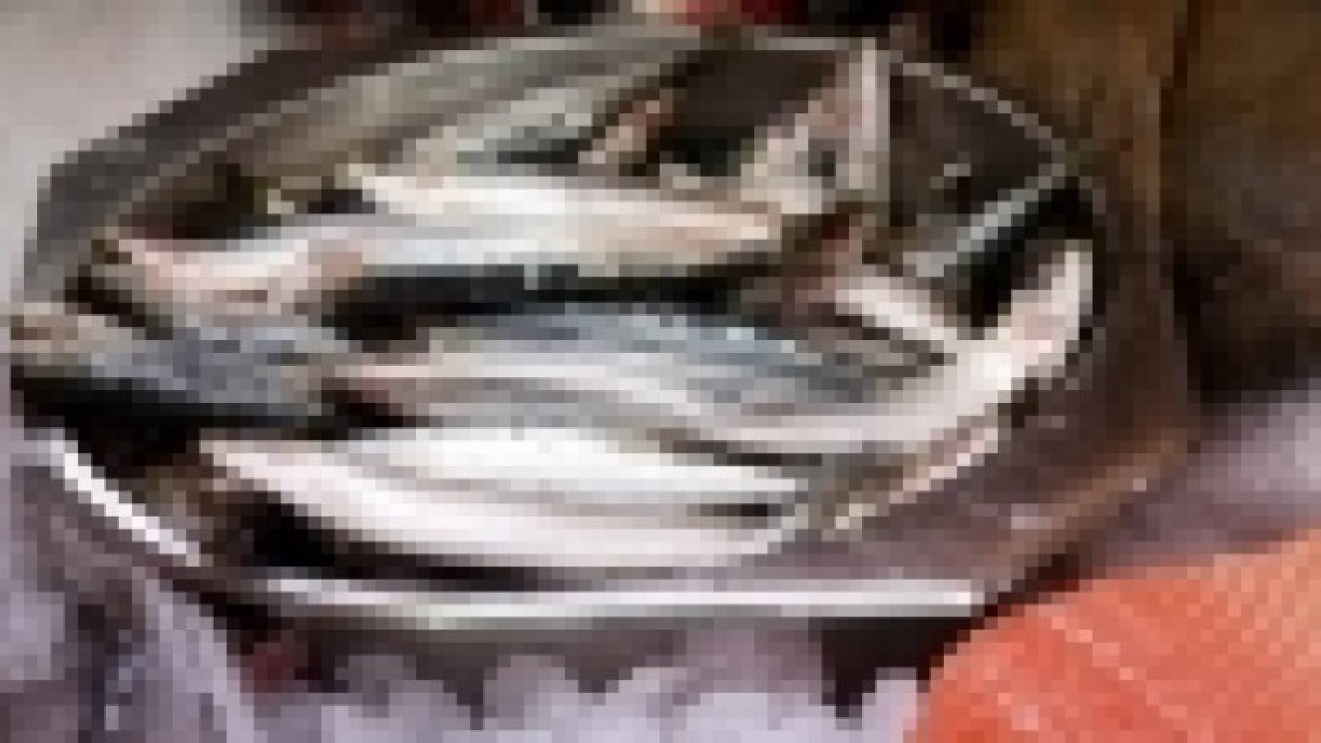 فيتامين "د" أثناء الحمل يقي الأطفال من الحساسية