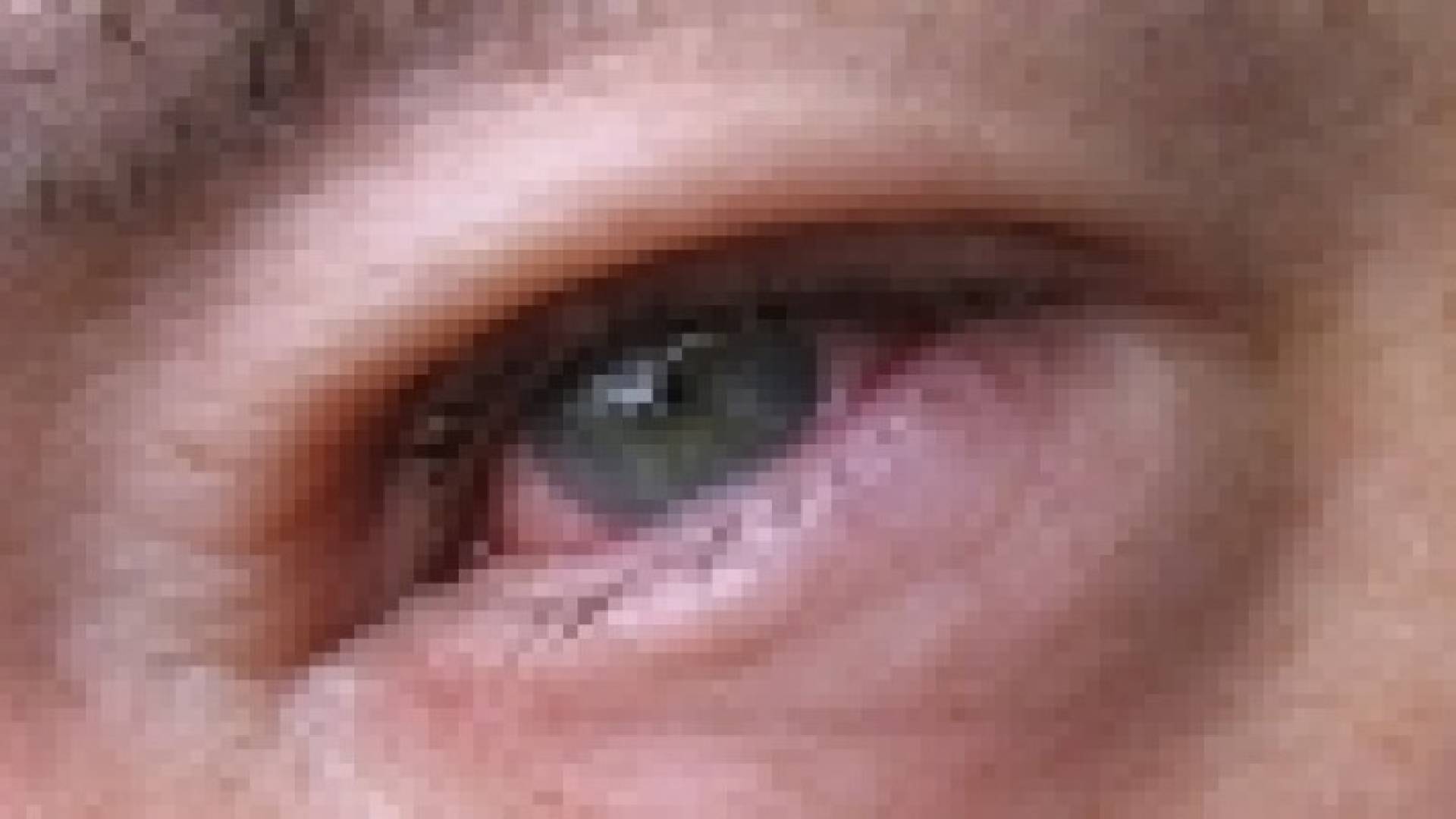 ‫احمرار العين.. حساسية أم عدوى؟