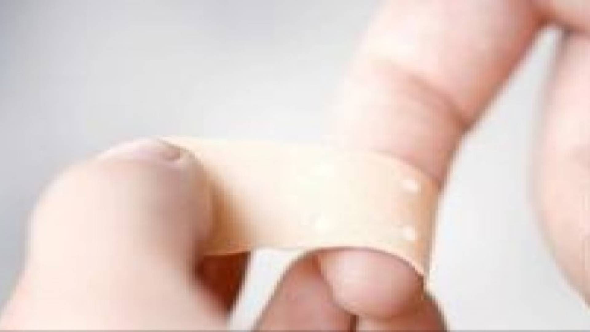 كيف تعالج جروح السكين البسيطة