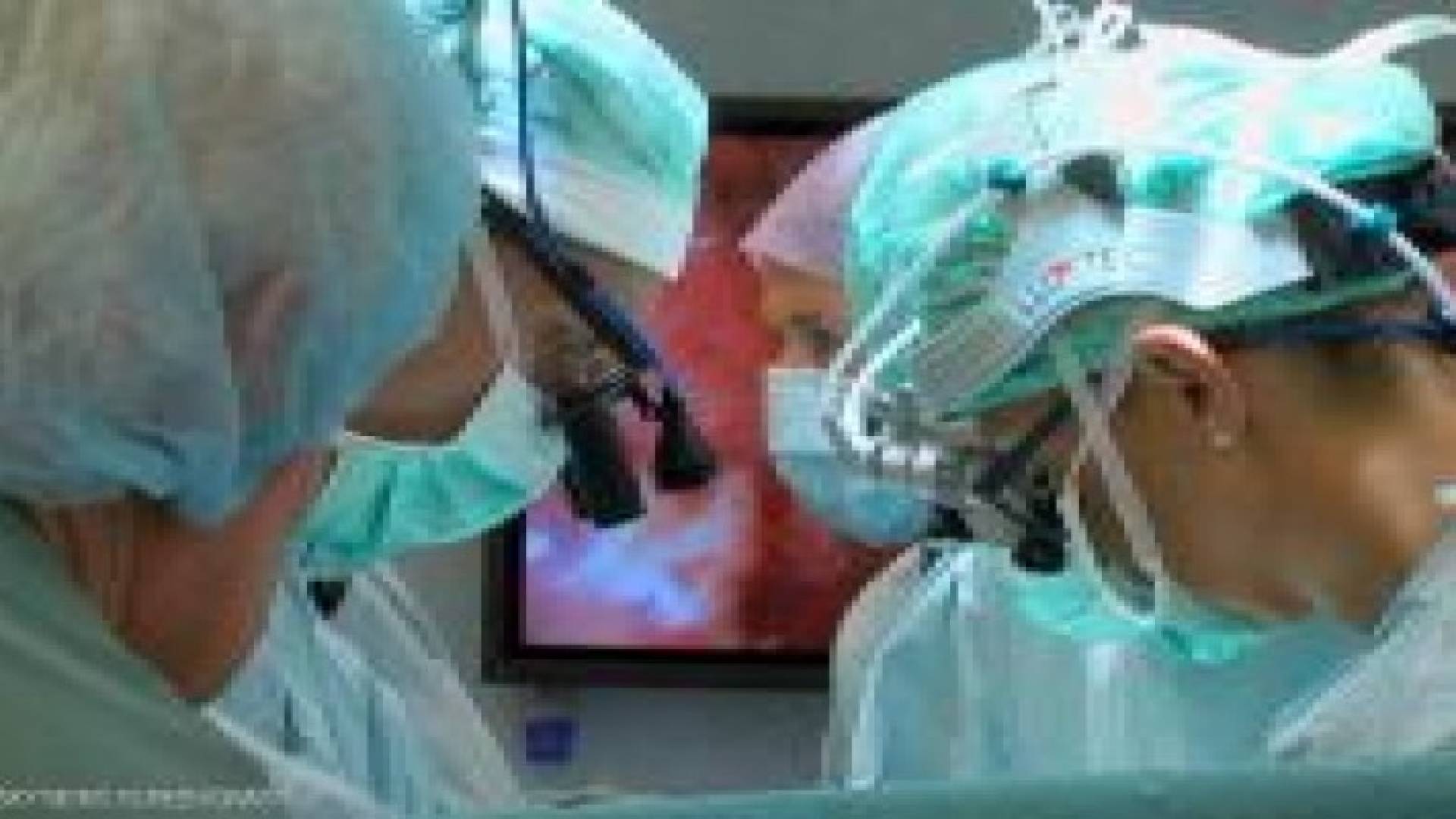 أول عملية زرع رحم في الولايات المتحدة