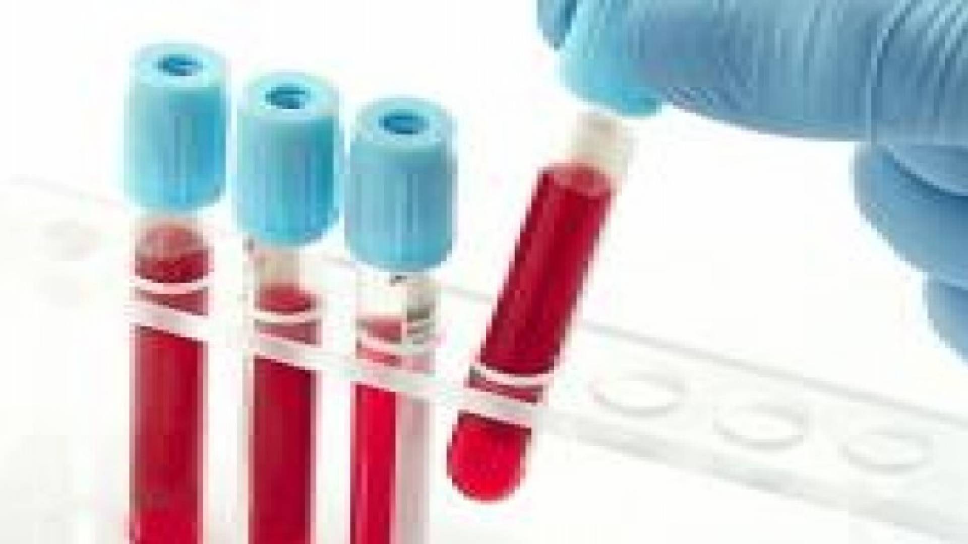 تطبيق النظام المعدل للفحص الطبي قبل الزواج في حزيران