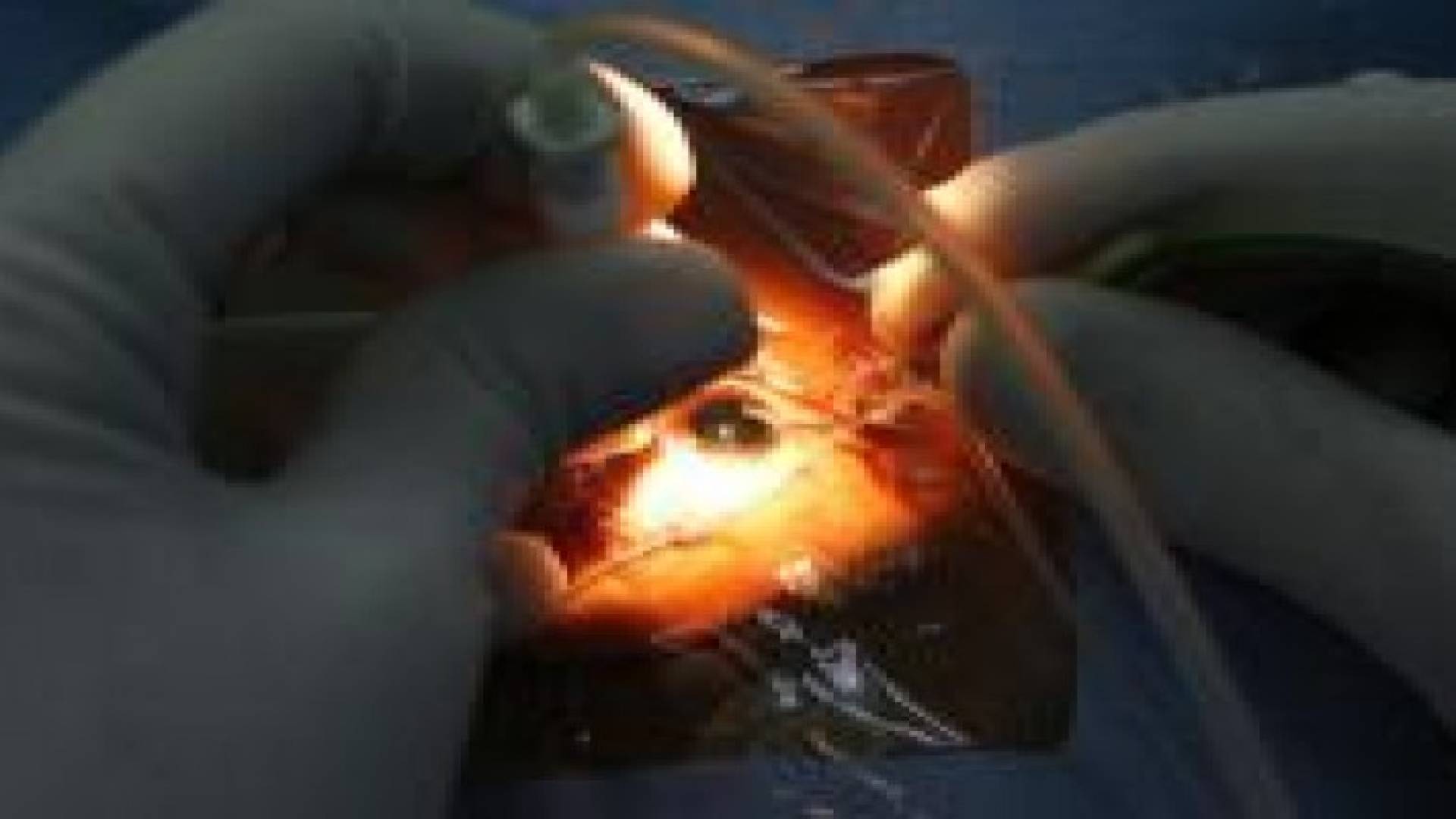 قرنية خنزير تعيد النظر لفتى صيني