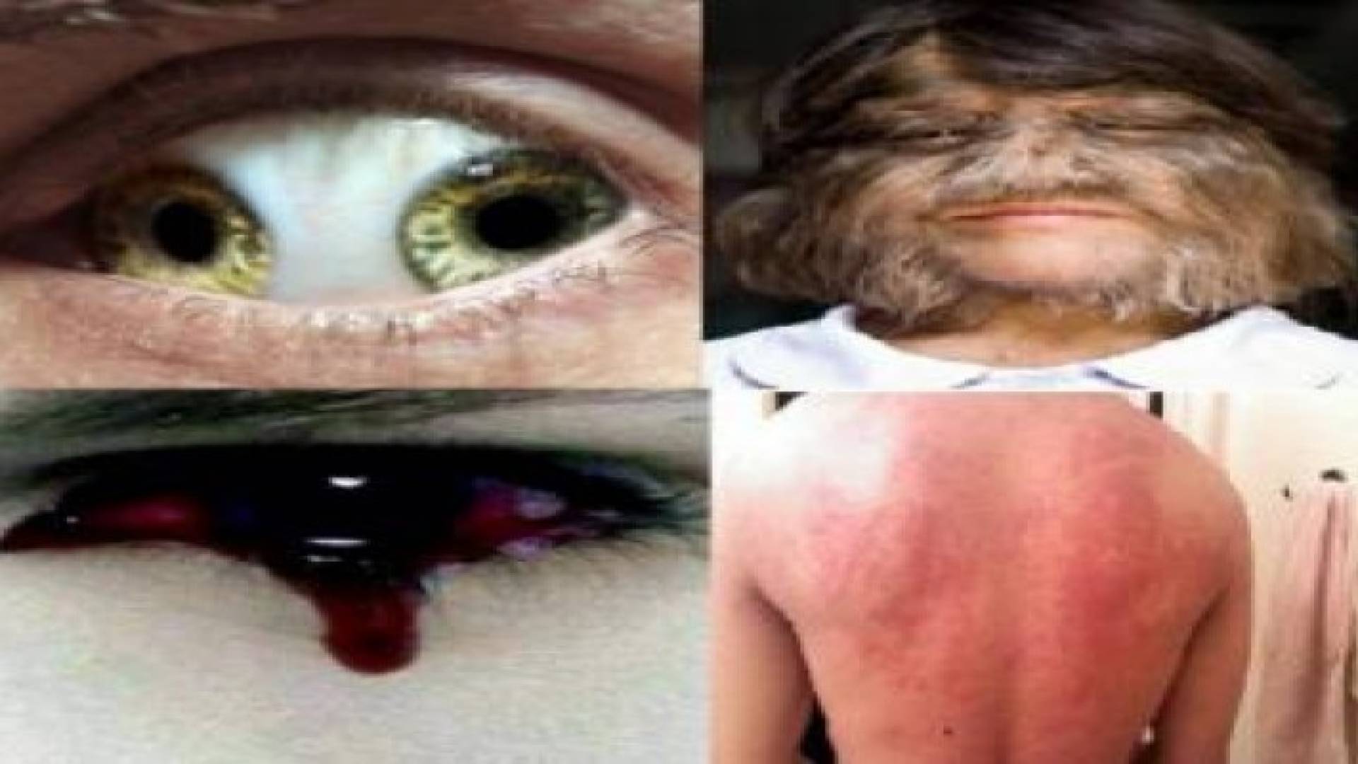 أغرب الحالات الطبية التي مرت على العالم