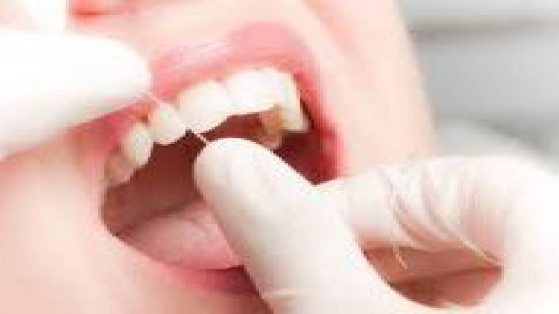 توصية بتنظيف الفراغات بين الأسنان مرة يوميا