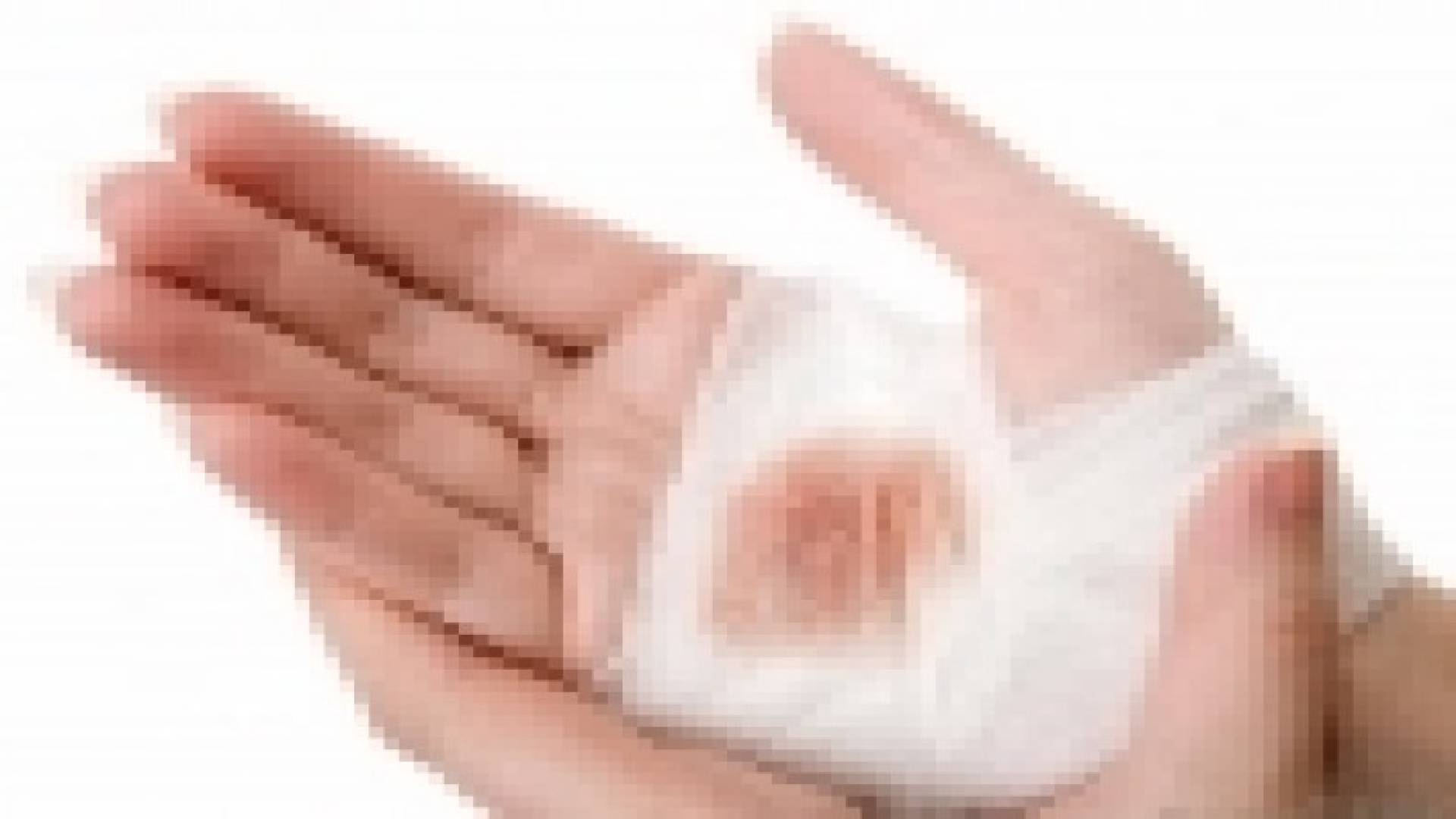 متى تستلزم الجروح استشارة الطبيب؟‬
