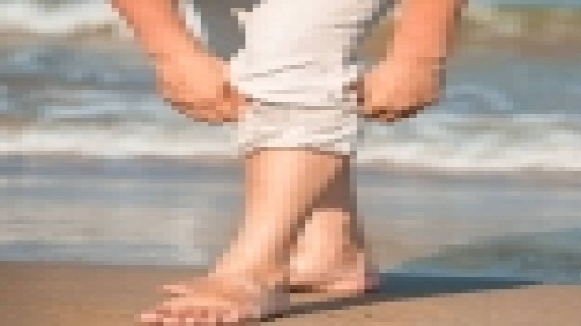 دوالي الساقين مؤشر على مشاكل صحية أخرى
