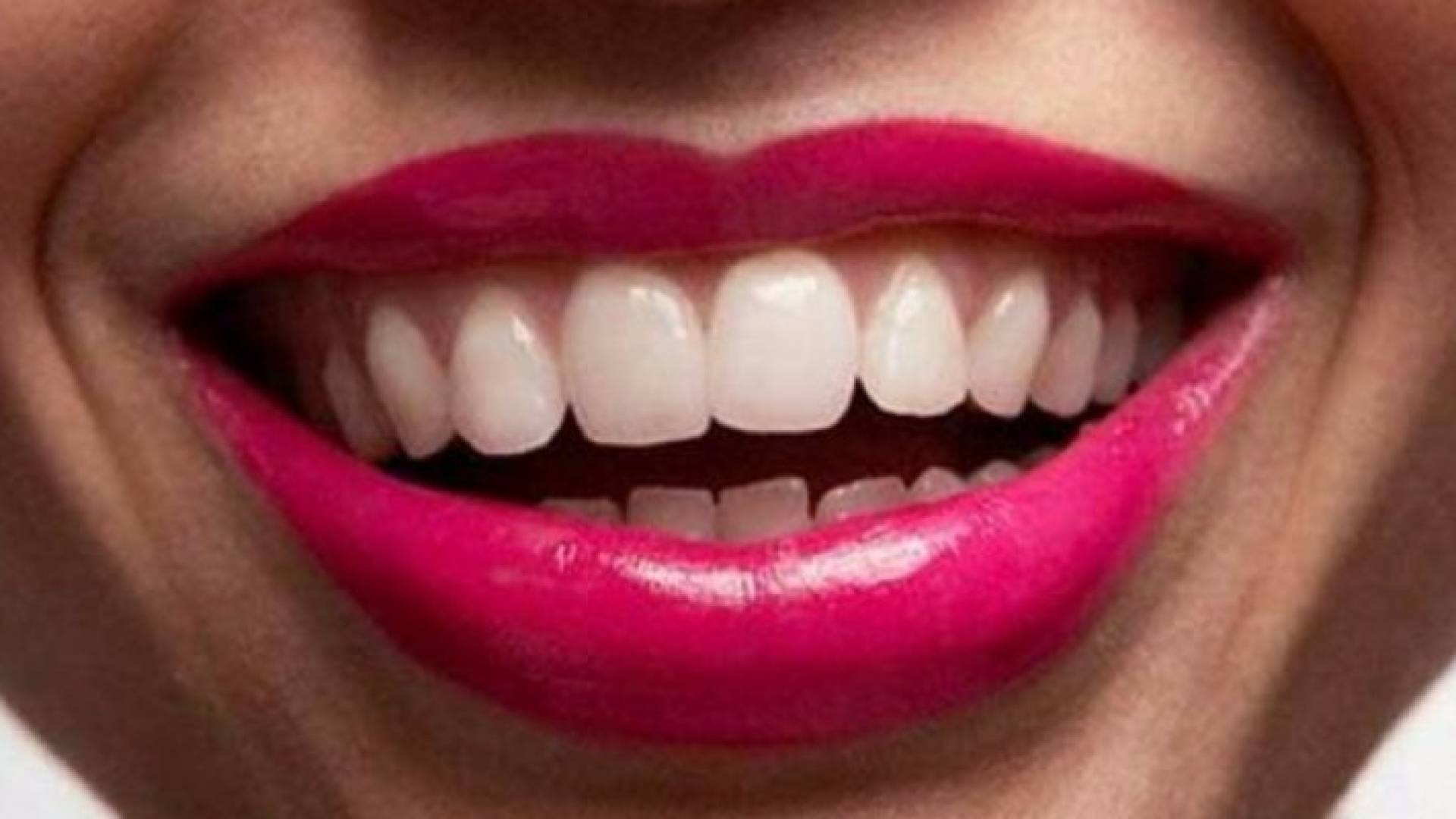 السباحة والحمضيات.. ضمن 10 أشياء تدمر أسنانك