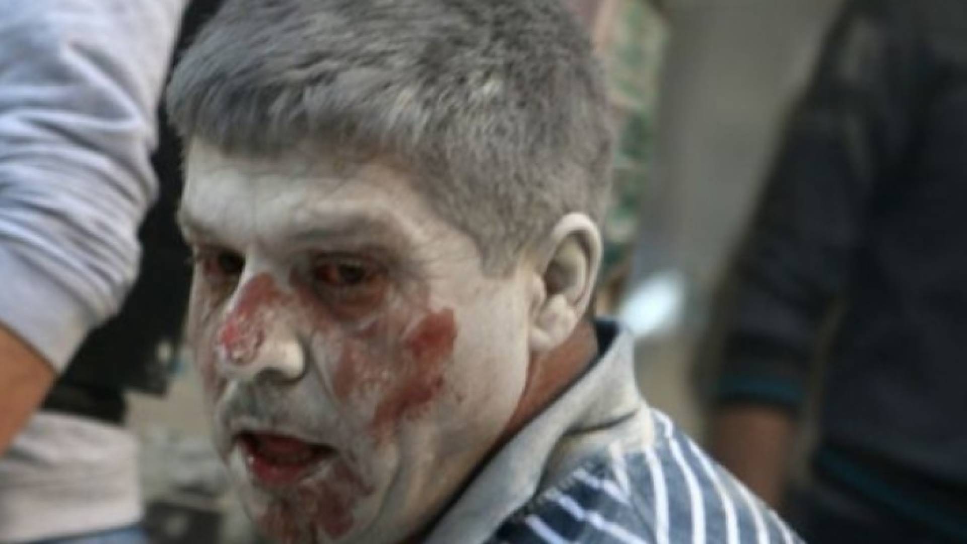  وردت تقارير عن مقتل 250 شخصا في حلب في الأيام التسعة الأخيرة 