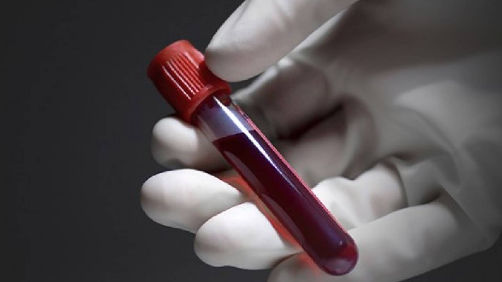 الصورة تعبيرية