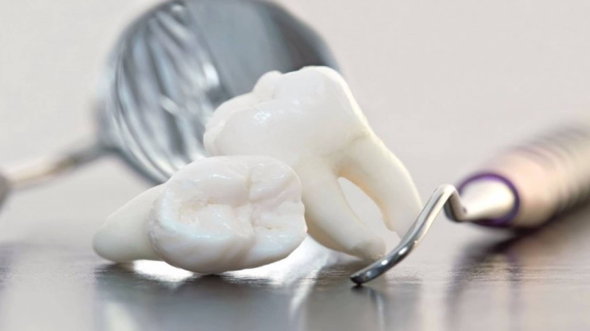 هل لخلع ضرس العقل ضرورة؟