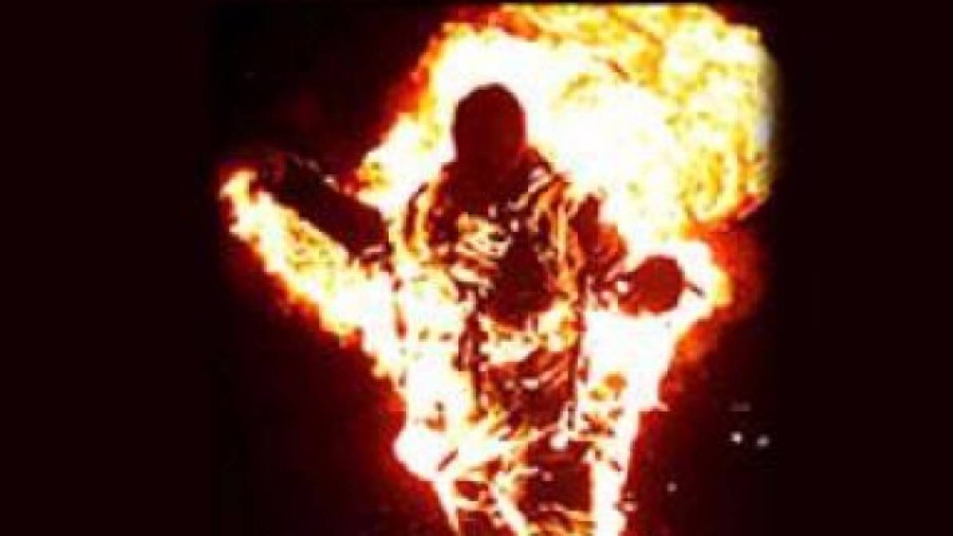 مواطن مريض نفسي يحرق نفسه في الزرقاء