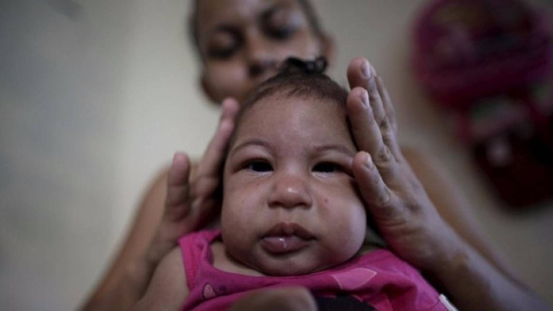 جديد زيكا.. طفل الأشهر الأخيرة من الحمل قد ينجو