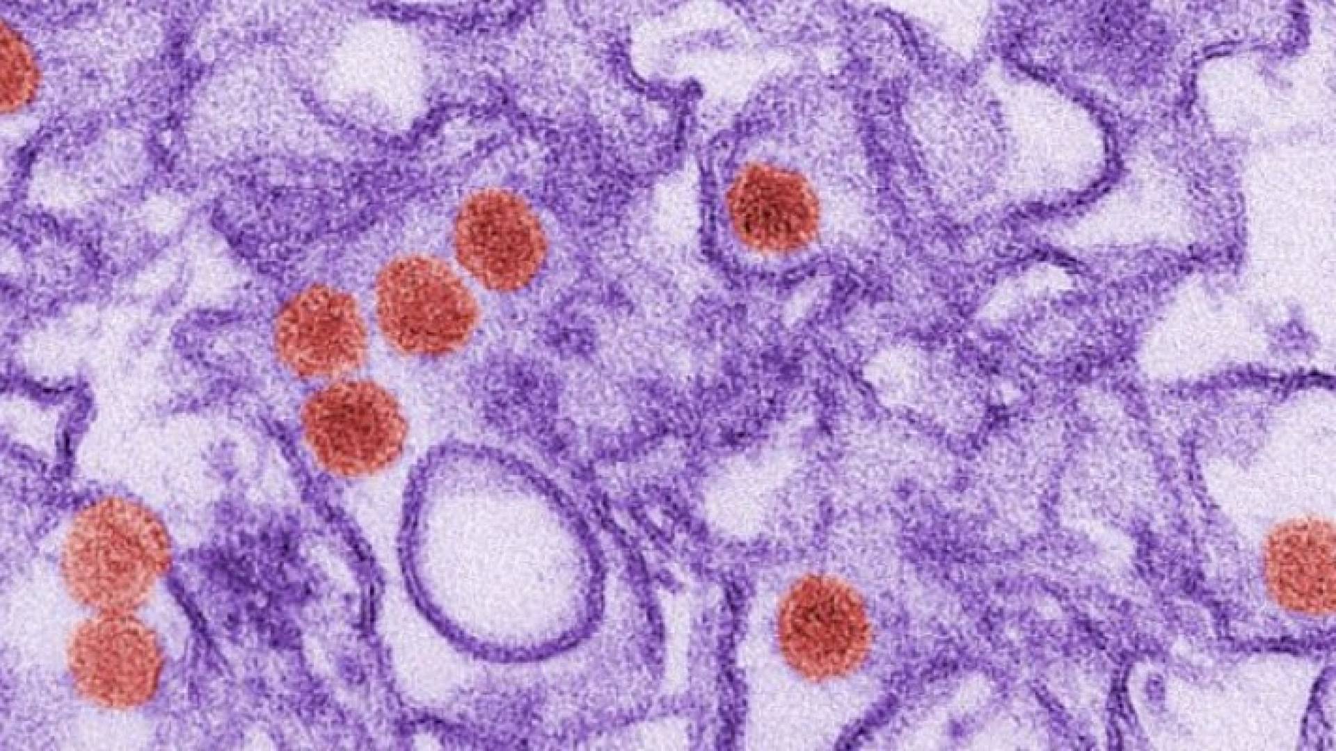 نجاح اختبار لقاحين جديدين ضد فيروس زيكا