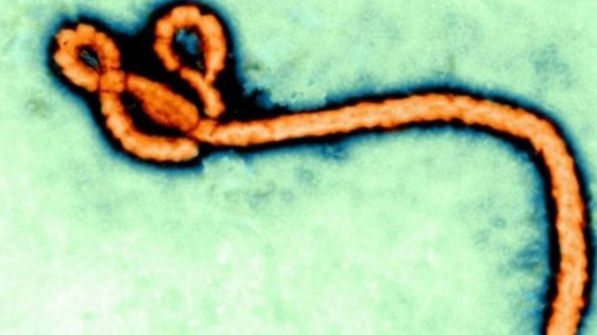 دراسة: مسكن الألم آيبوبروفين قد يبطل مفعول فيروس إيبولا