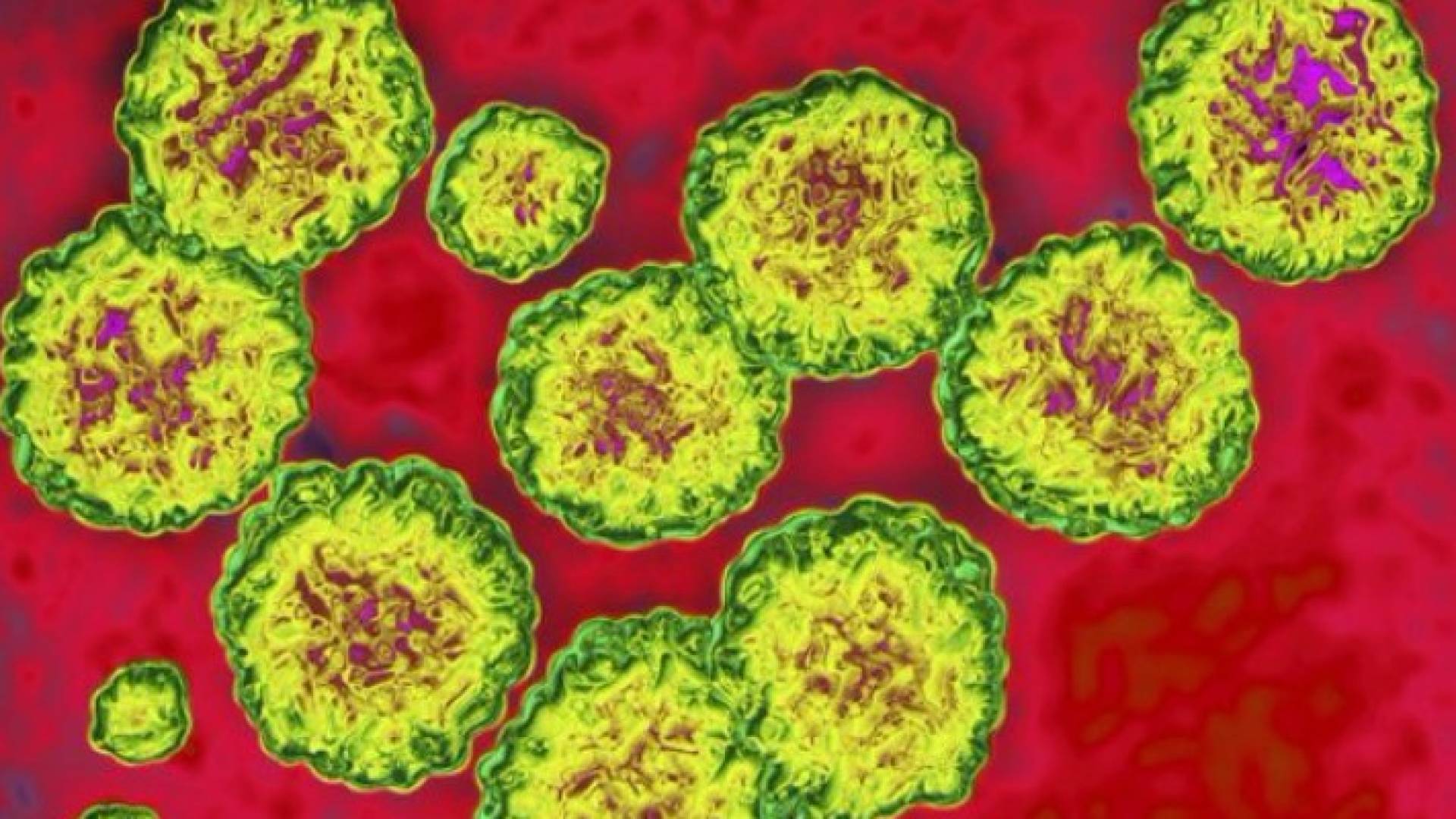 تقرير: التهاب الكبد الفيروسي يصبح سببا رئيسيا للوفاة والاعاقة