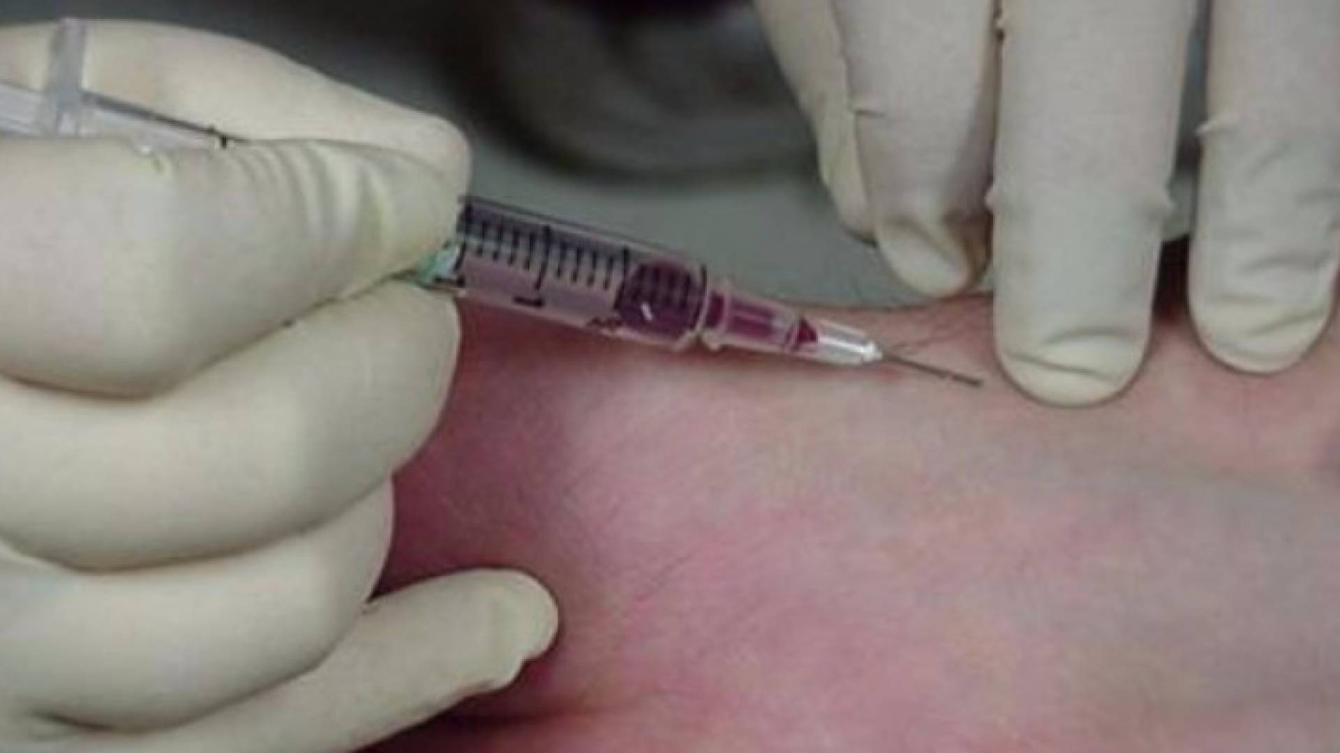 كيف يؤثر سن وجنس واهب الدم على حياة المتلقي؟