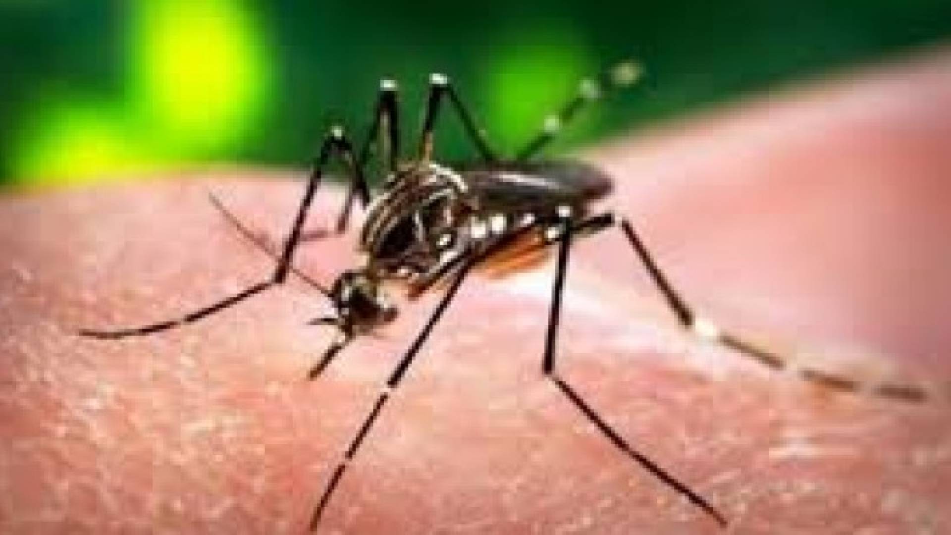 أطباء أمريكيون يضعون خطة لرعاية أطفال أصيبت أمهاتهم بفيروس زيكا